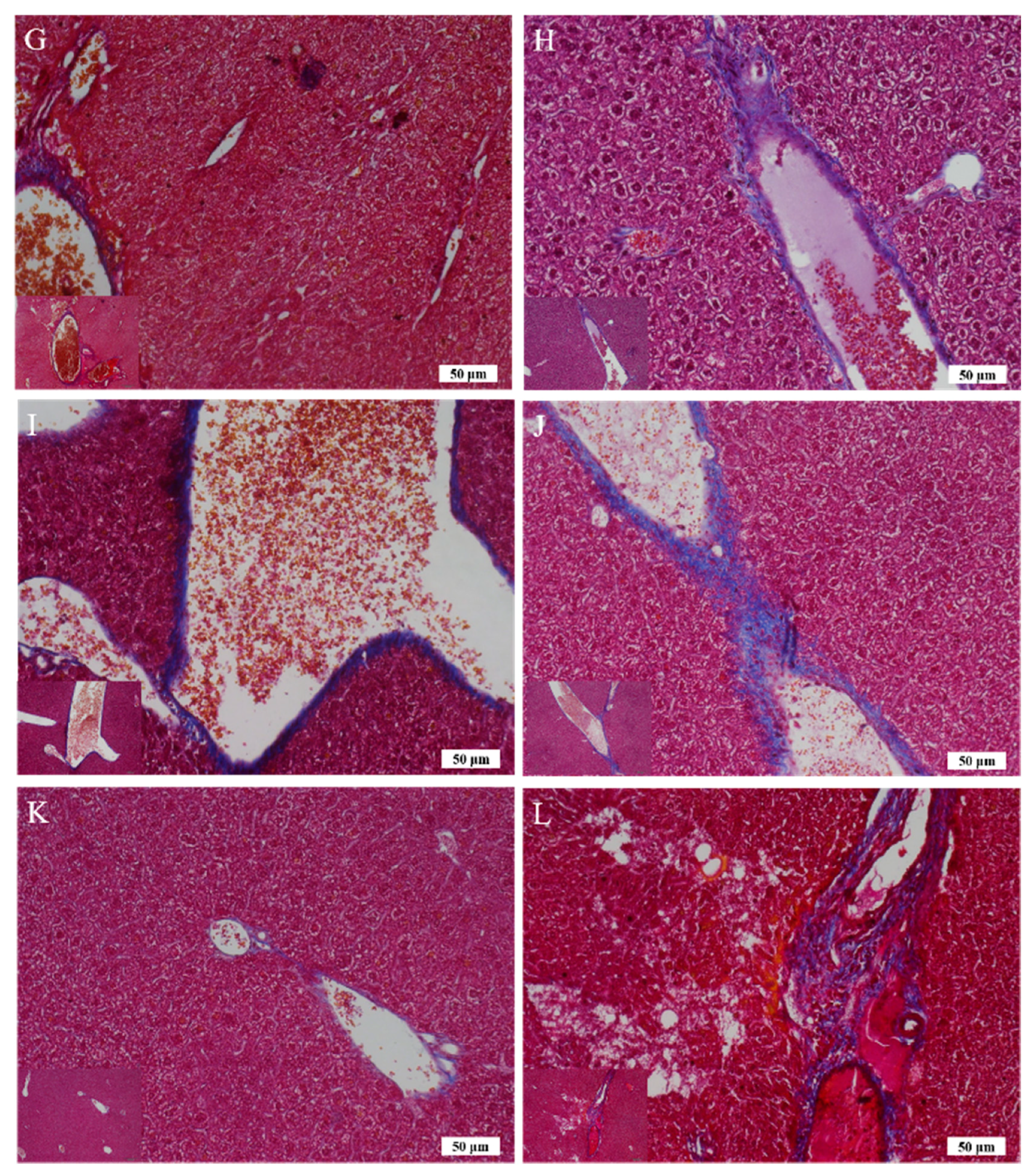 Ijms 20 04057 g007b