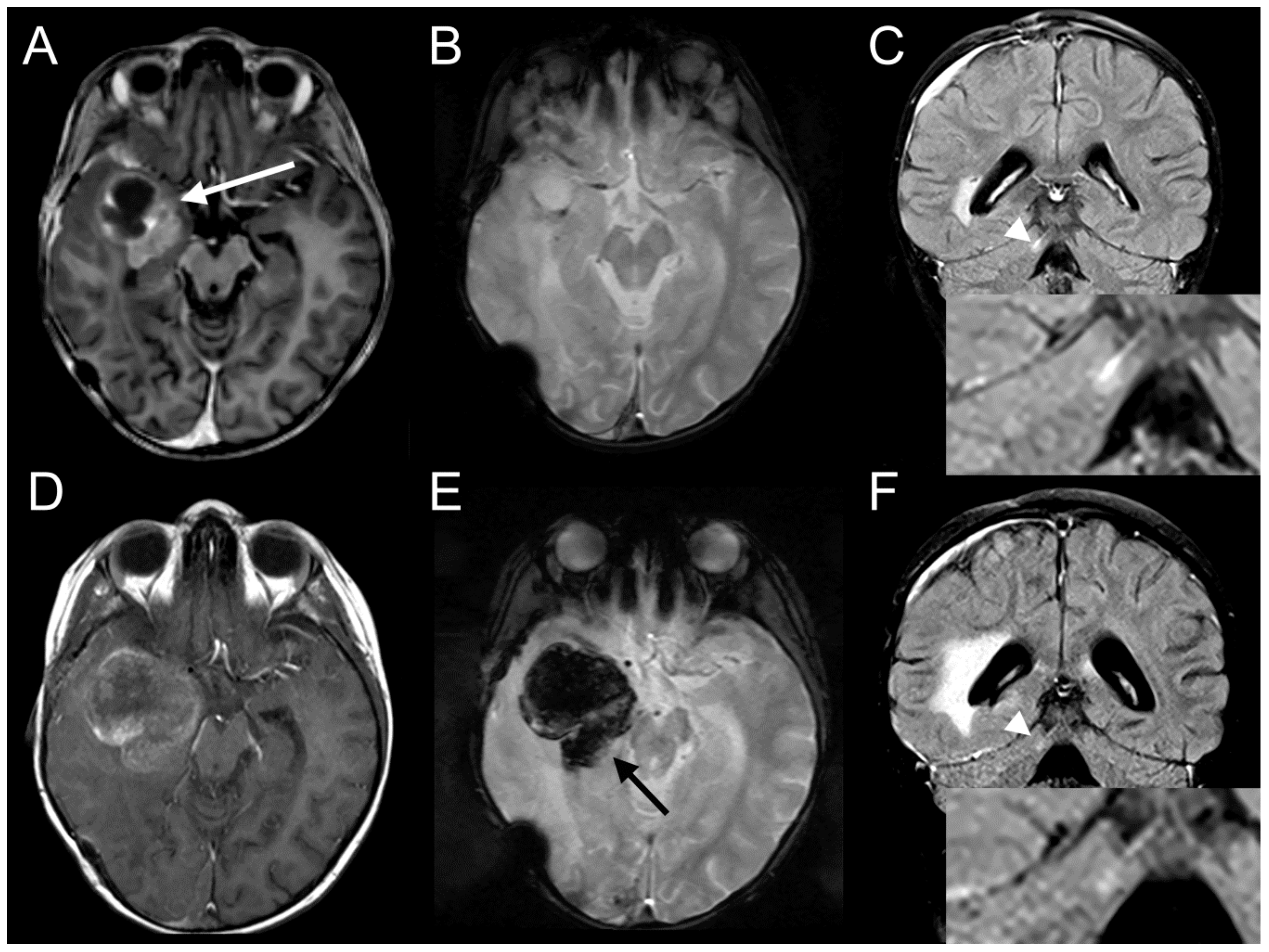 Ijms 20 04267 g007 Ijms 20 04267 g007