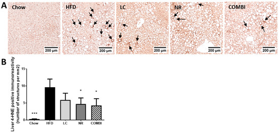 l carnitine and ubiquinone in pregnancy induced cramps L-Carnitine Plus