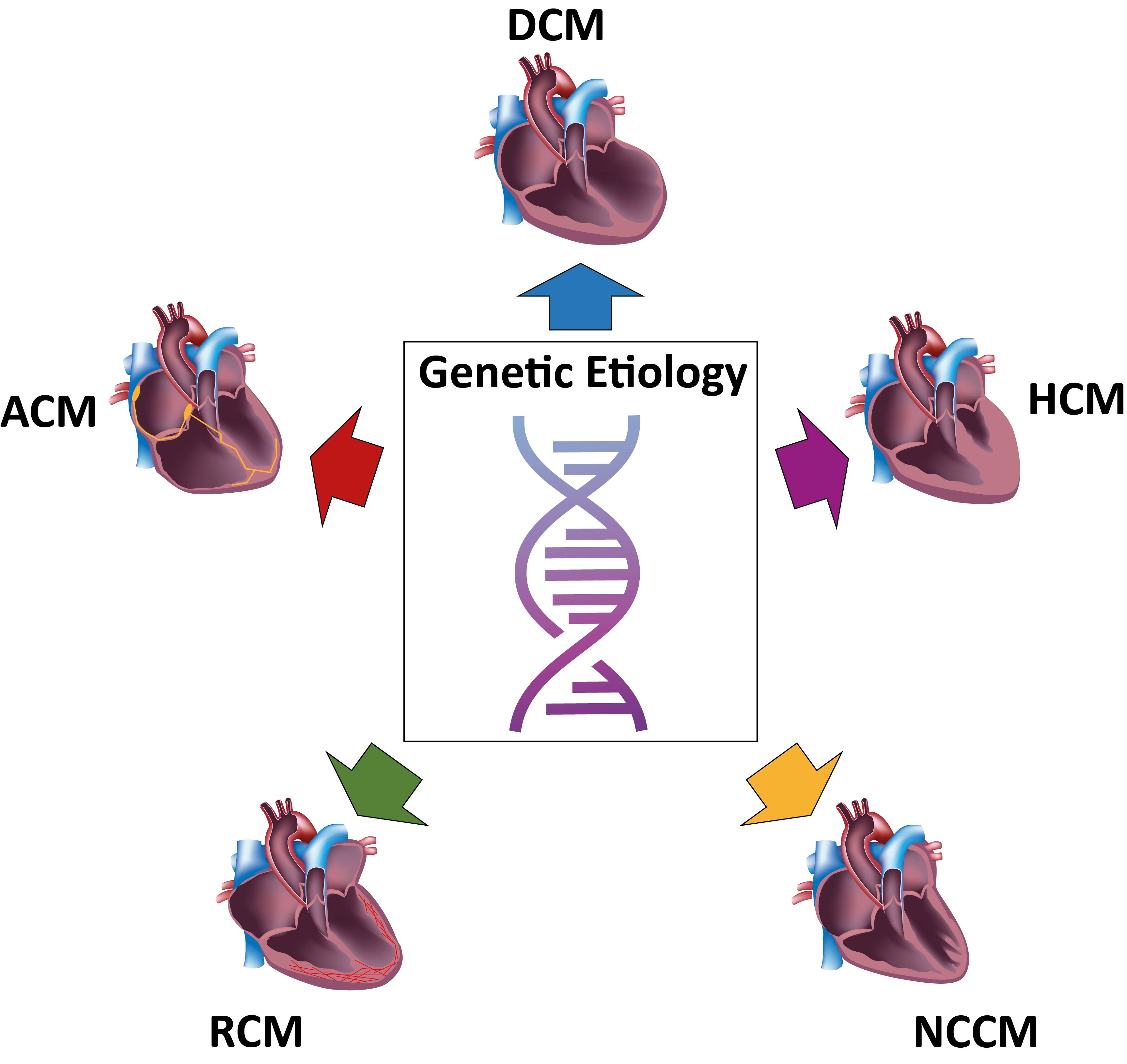 Ijms Free Full Text Human Induced Pluripotent Stem Cell Derived Cardiomyocytes As Models For Genetic Cardiomyopathies Html
