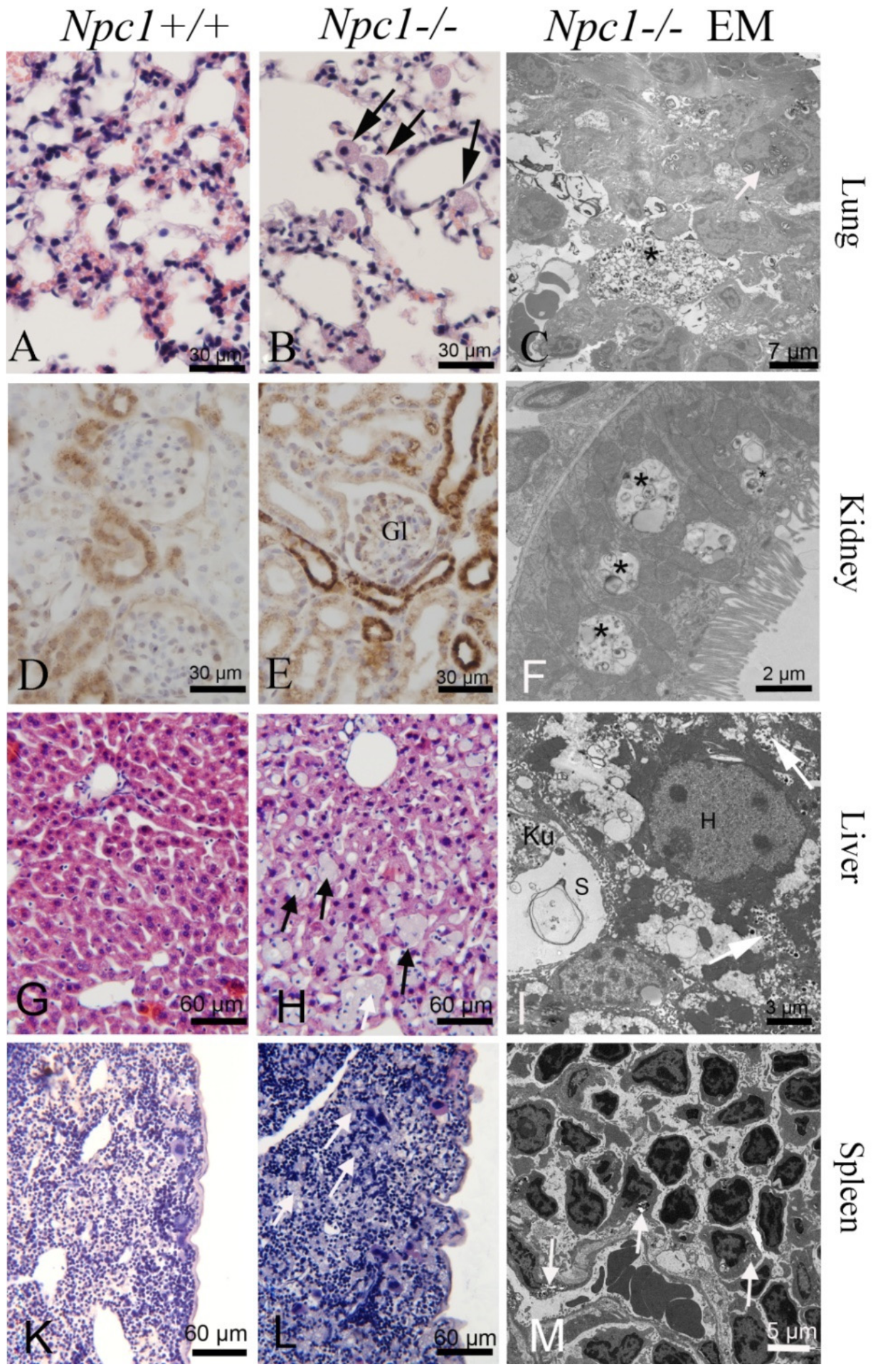 Niemann–Pick type C disease: cellular pathology and pharmacotherapy -  Wheeler - 2020 - Journal of Neurochemistry - Wiley Online Library
