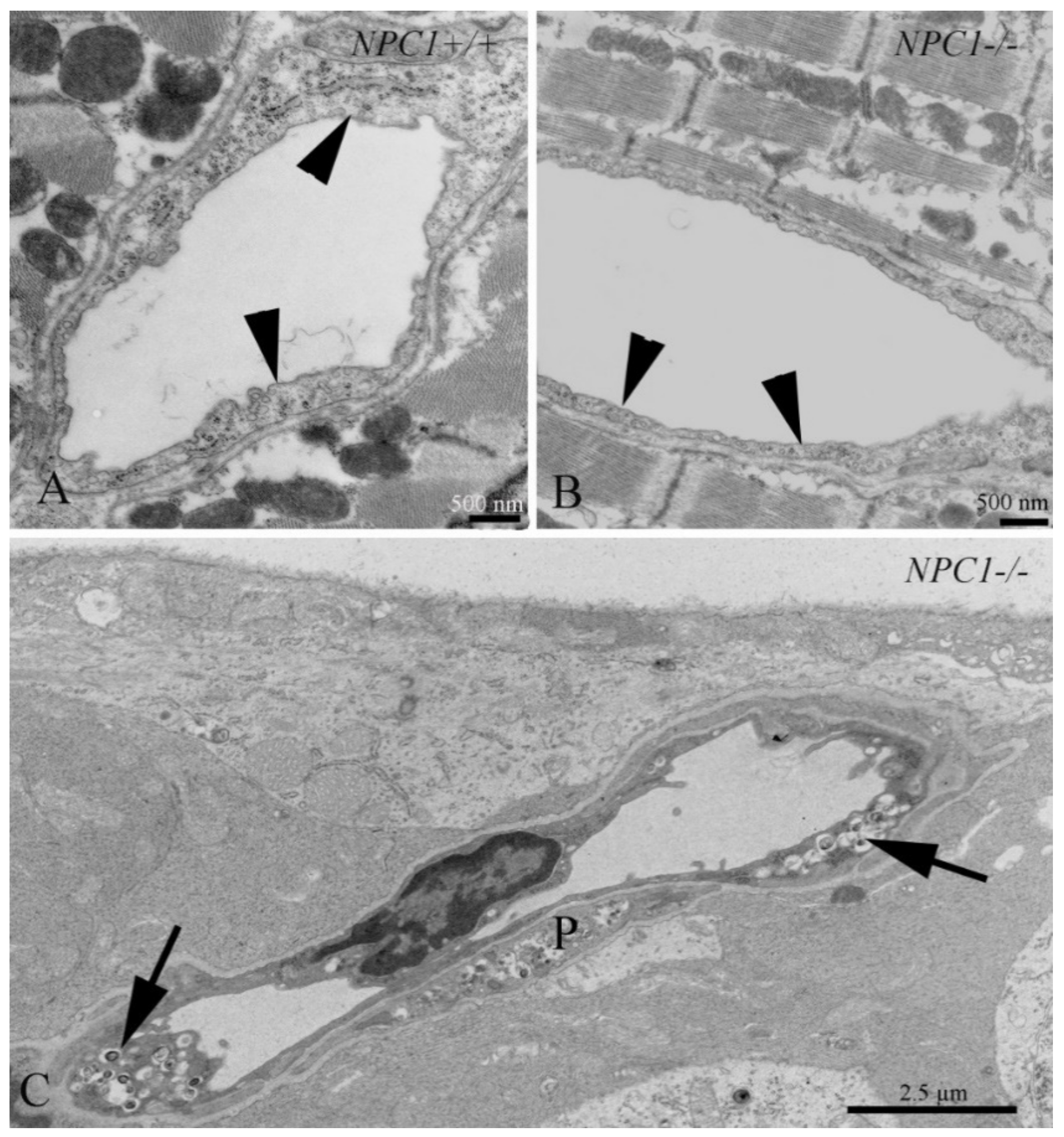 Niemann–Pick type C disease: cellular pathology and pharmacotherapy -  Wheeler - 2020 - Journal of Neurochemistry - Wiley Online Library