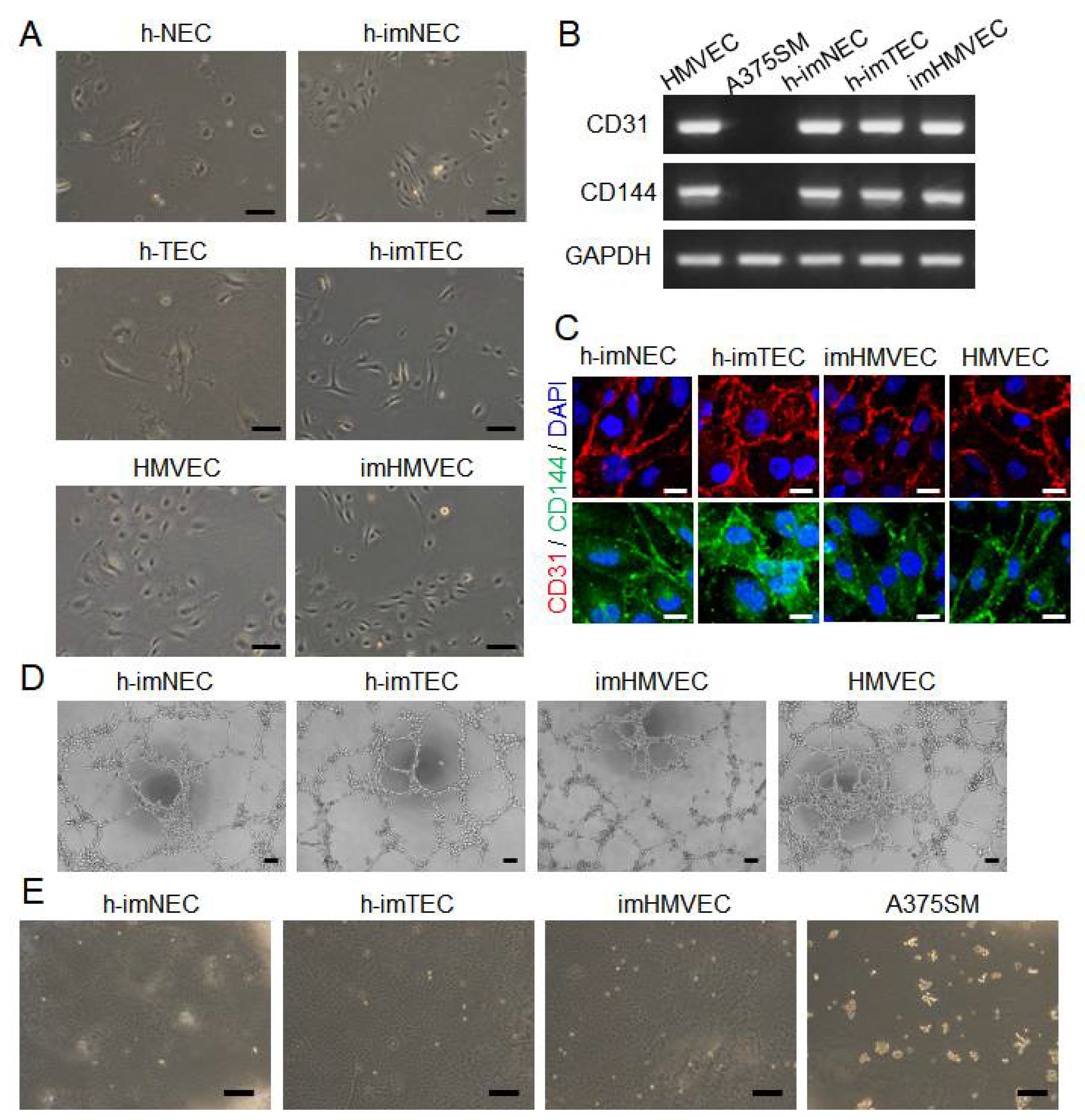 IJMS | Free Full-Text | Development of Immortalized Human Tumor Endothelial  Cells from Renal Cancer