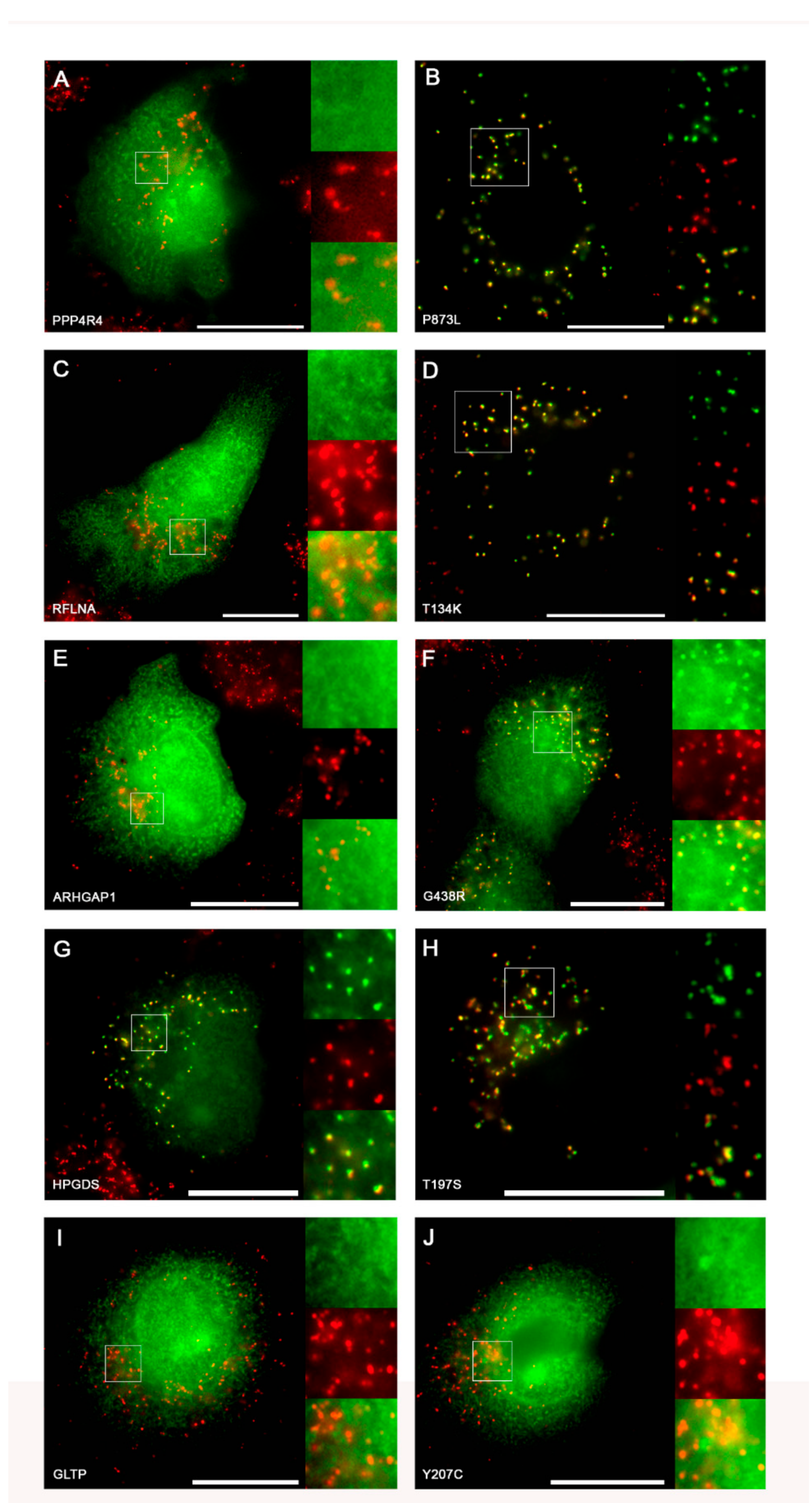 Ijms 20 04609 g004 Ijms 20 04609 g004