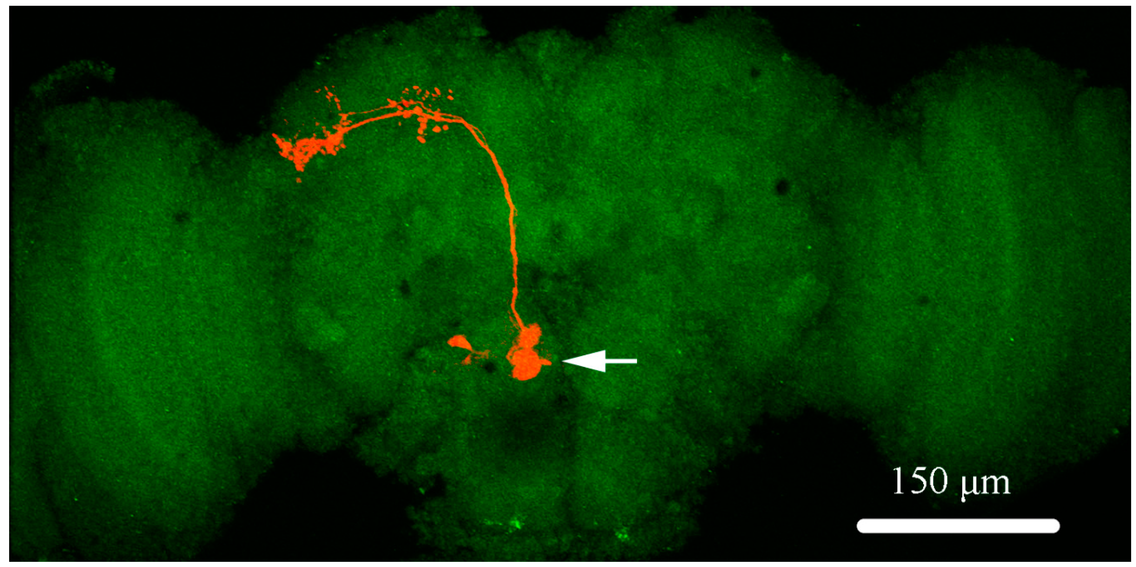 Ijms 20 04625 g001 Ijms 20 04625 g001