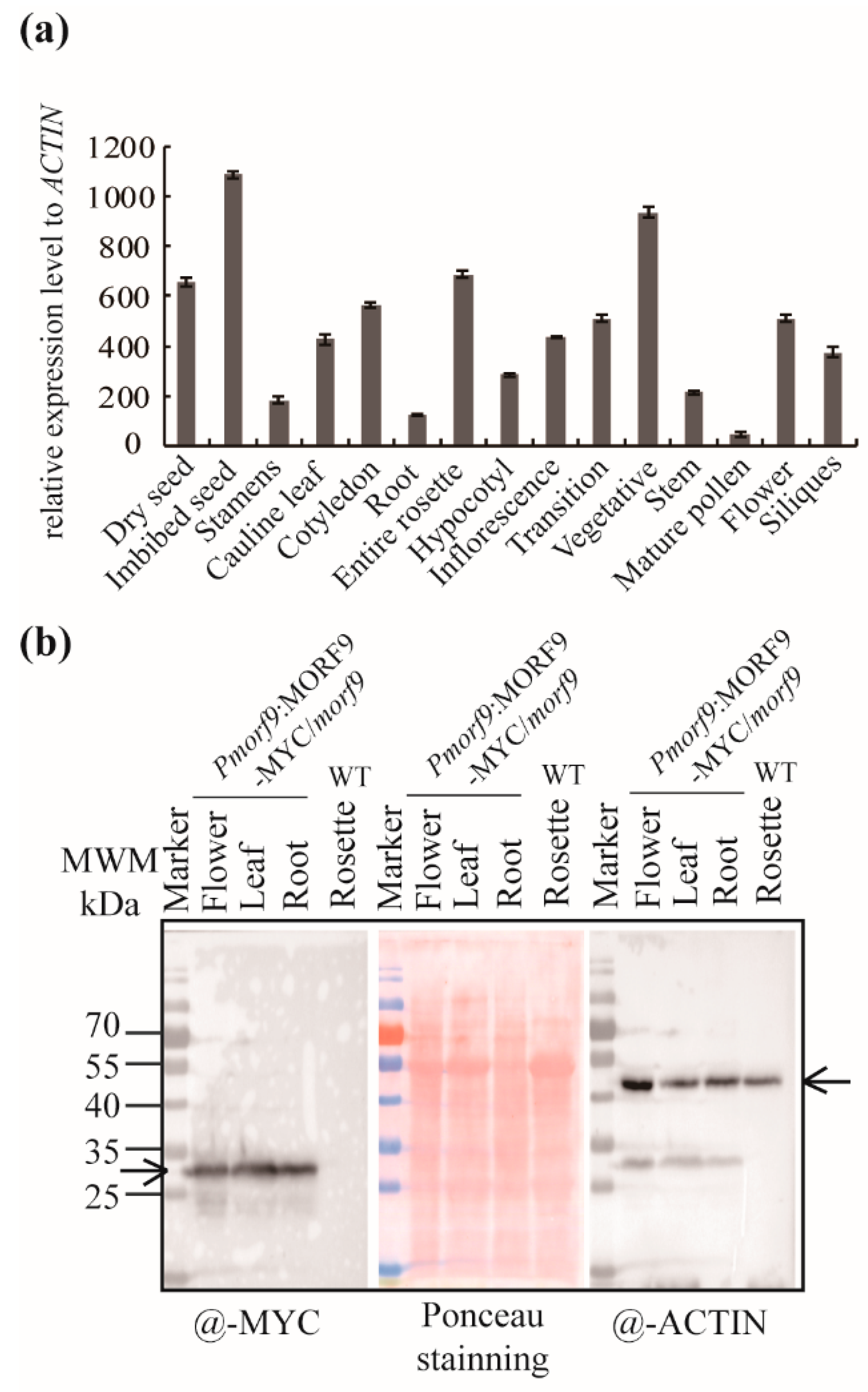 Ijms 20 04635 g004 Ijms 20 04635 g004