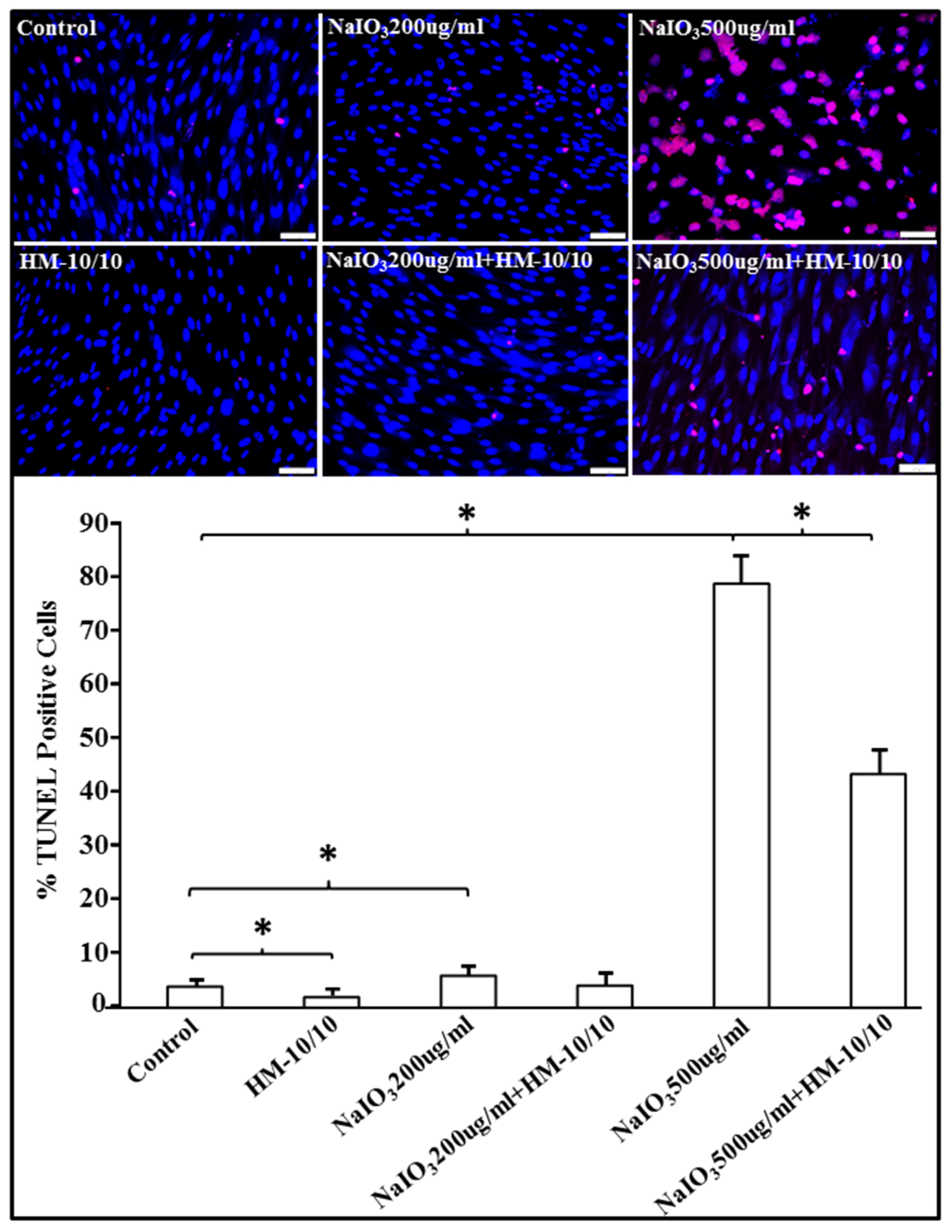 A Novel HDL-Mimetic Peptide HM-10/10 Protects RPE and