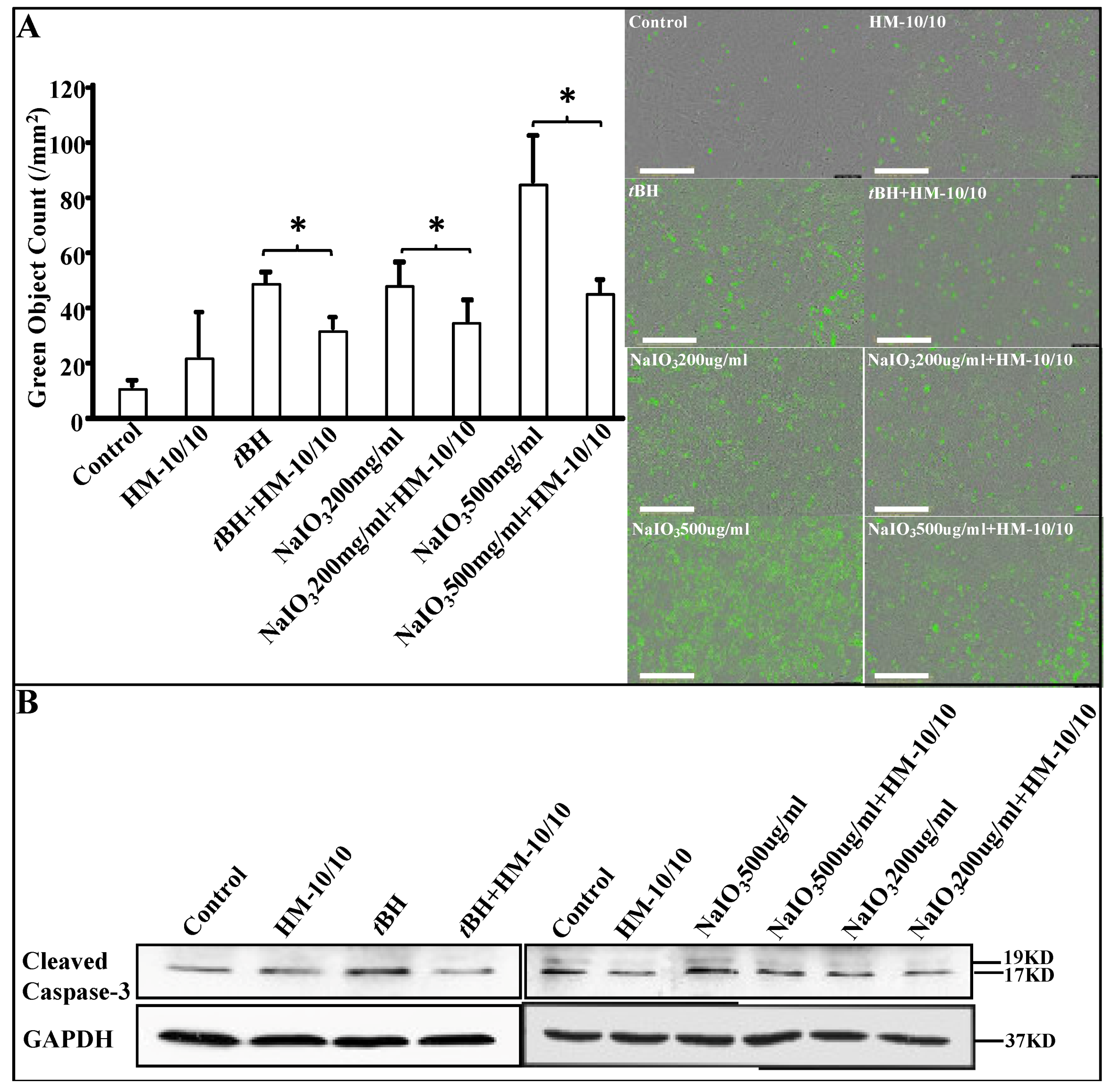 A Novel HDL-Mimetic Peptide HM-10/10 Protects RPE and