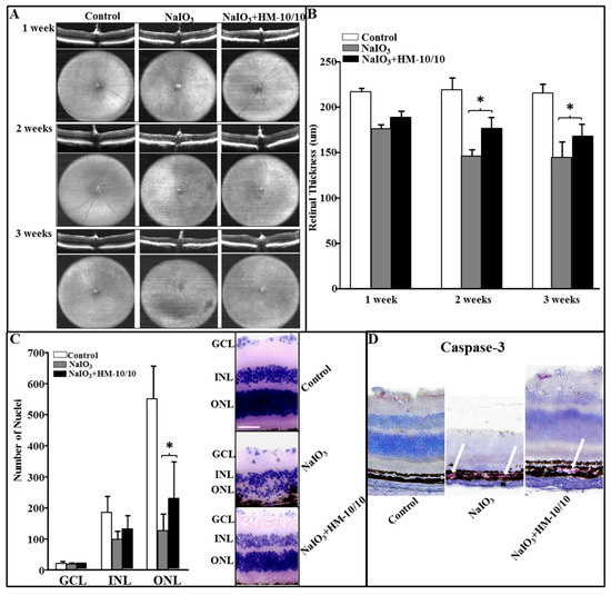 A Novel HDL-Mimetic Peptide HM-10/10 Protects RPE and
