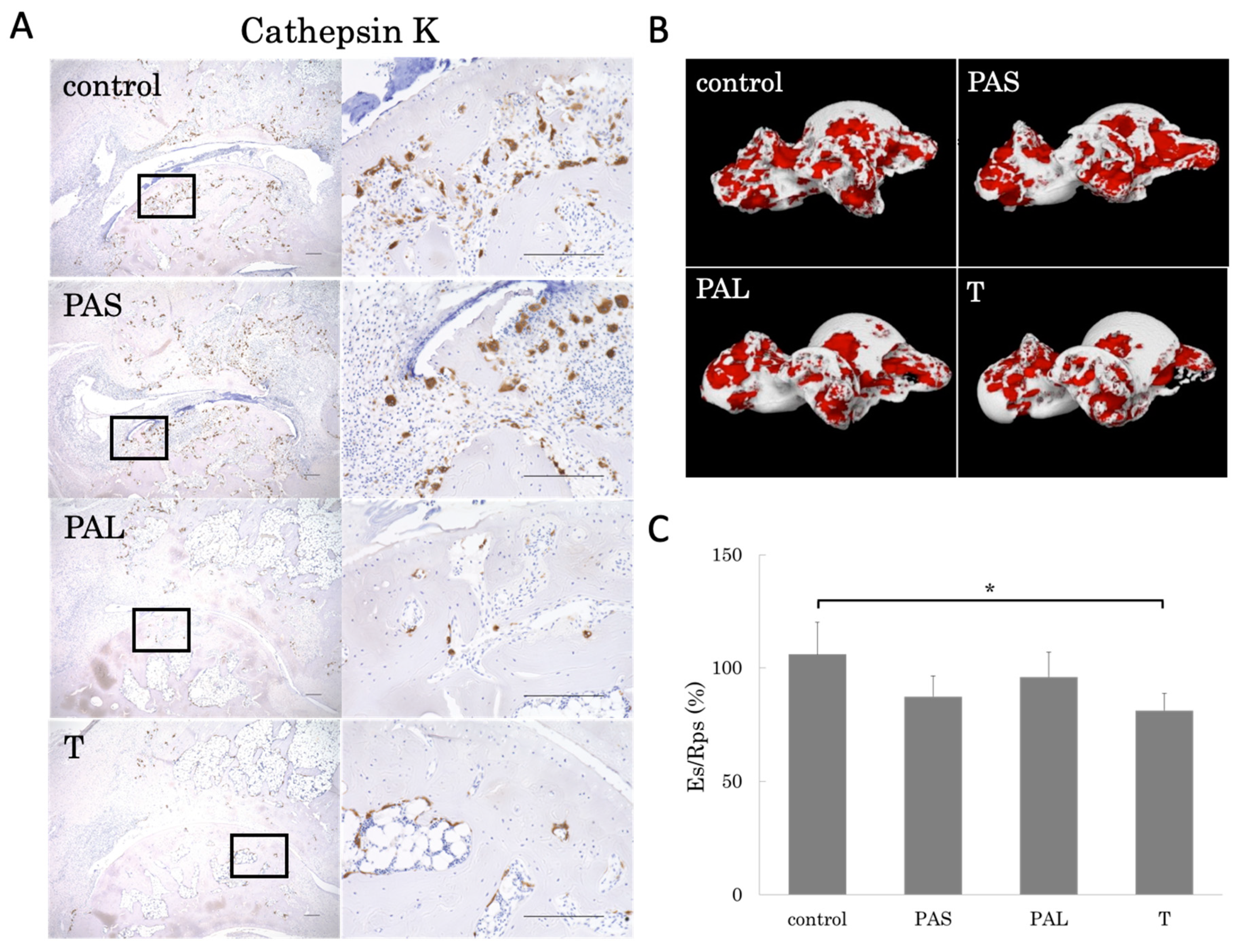 IJMS Free FullText Treadmill Running in Established Phase