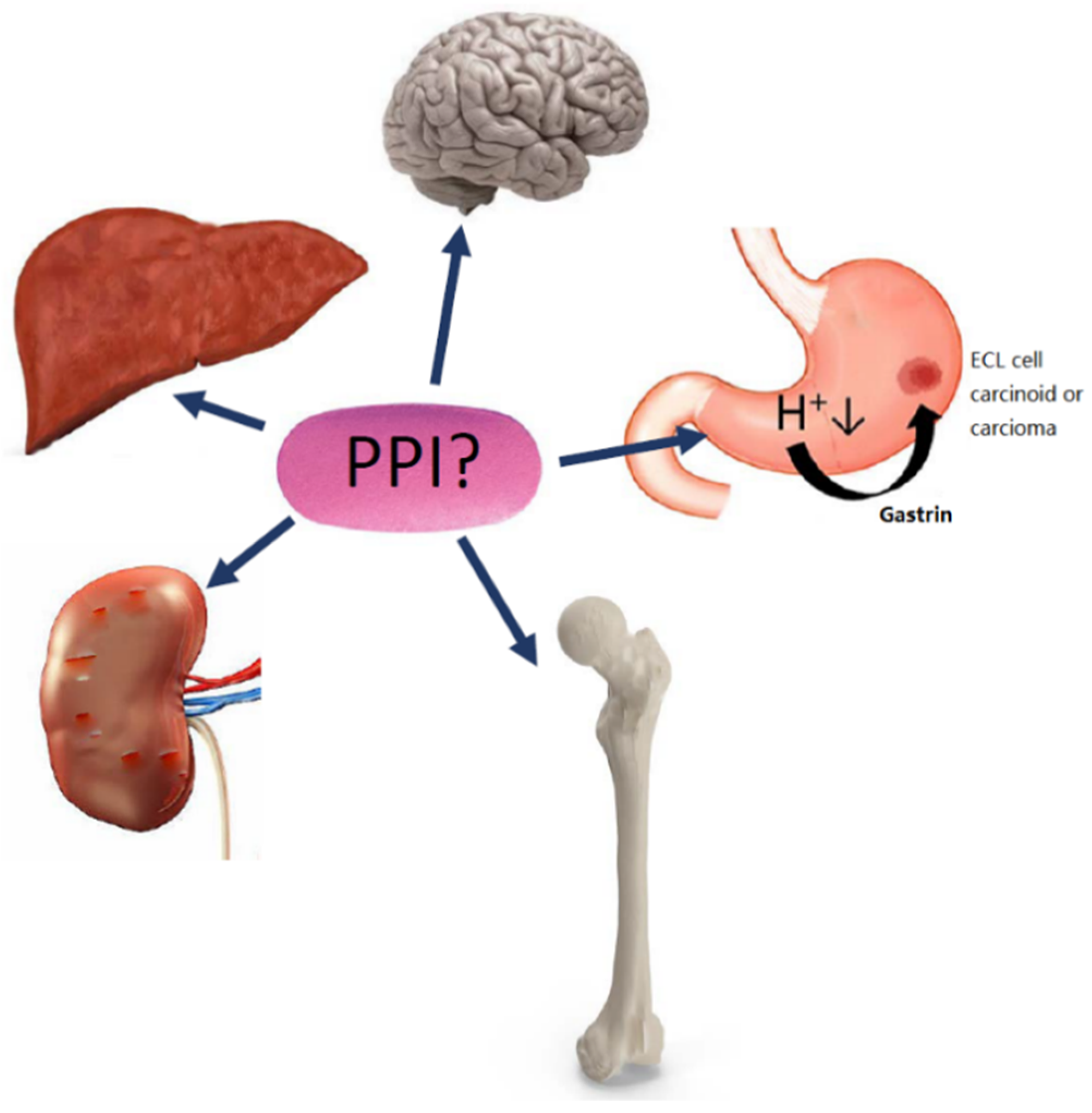 Ijms Free Full Text Adverse Effects Of Proton Pump Inhibitors Evidence And Plausibility Html