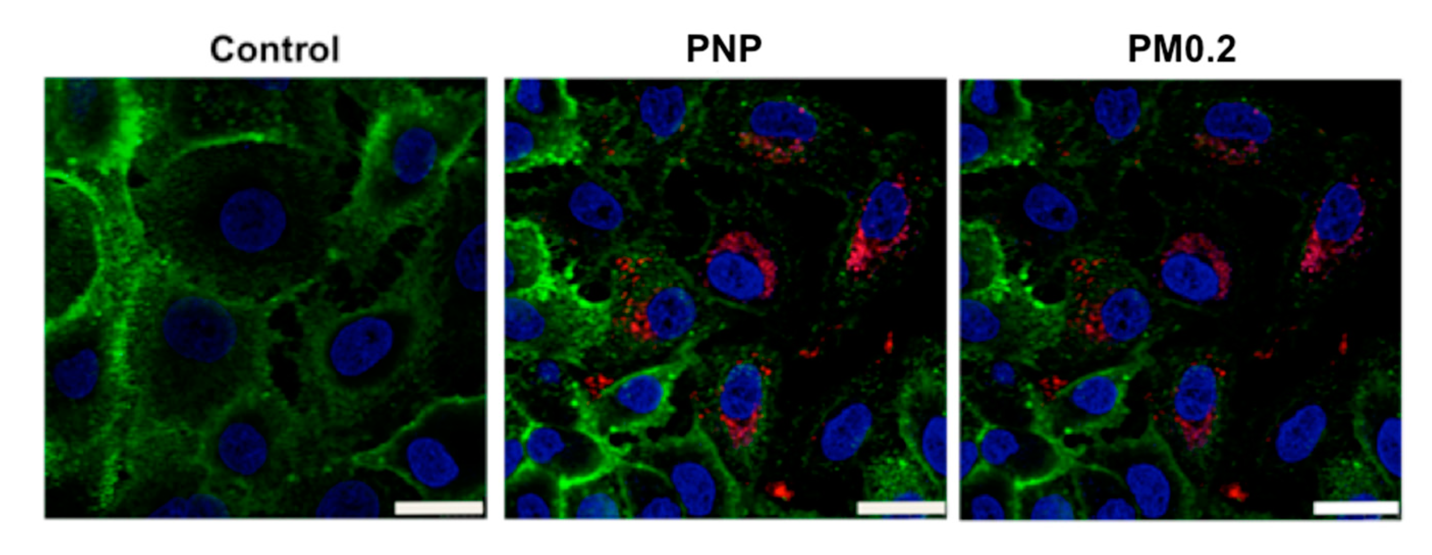 Ijms 20 05253 g005 Ijms 20 05253 g005