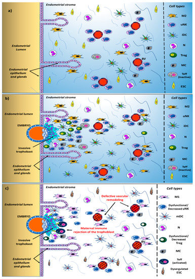 Ijms Free Full Text Endometrial Immune Dysfunction In Recurrent Pregnancy Loss Html