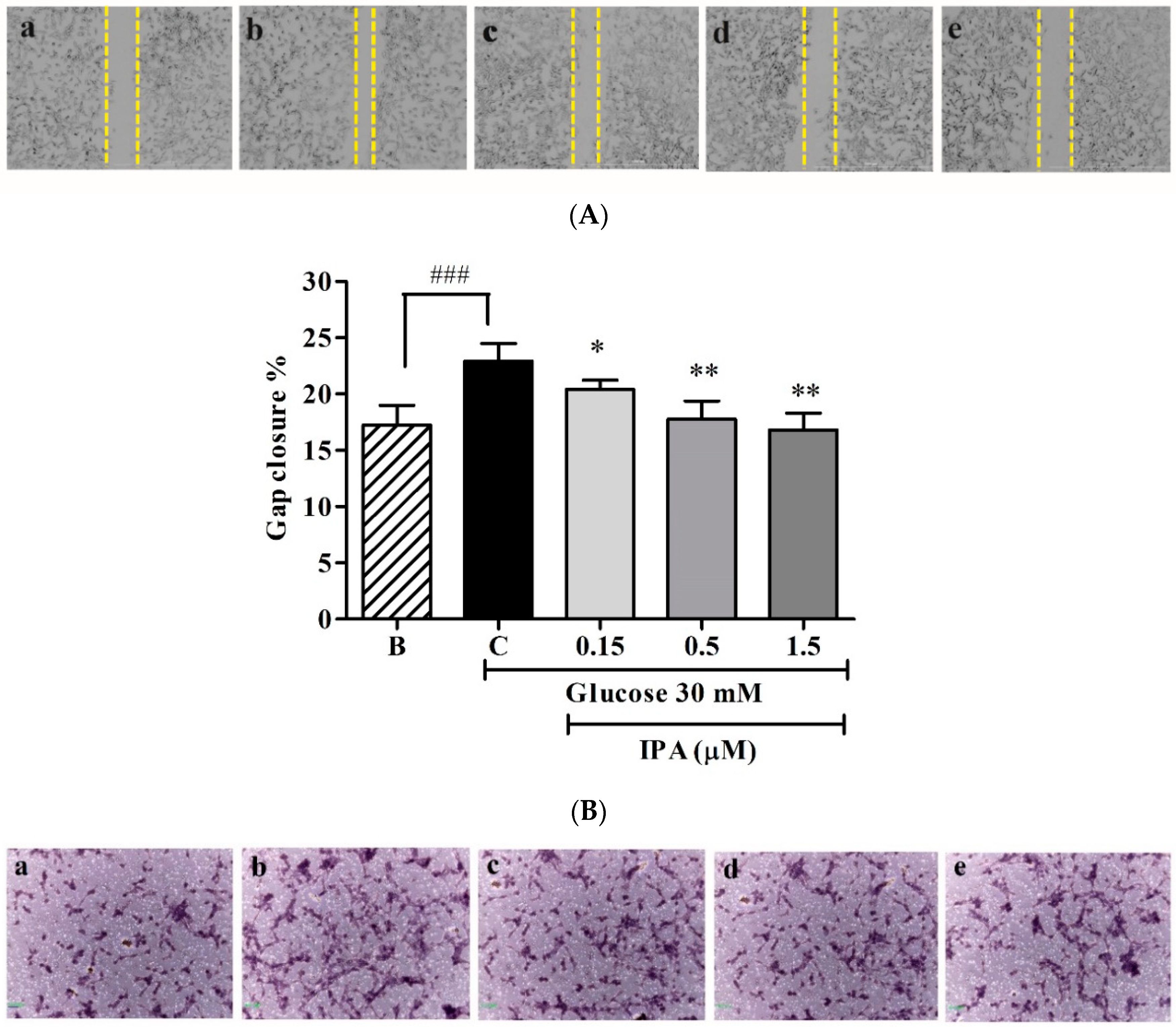 Ijms 20 05542 g004a Ijms 20 05542 g004a
