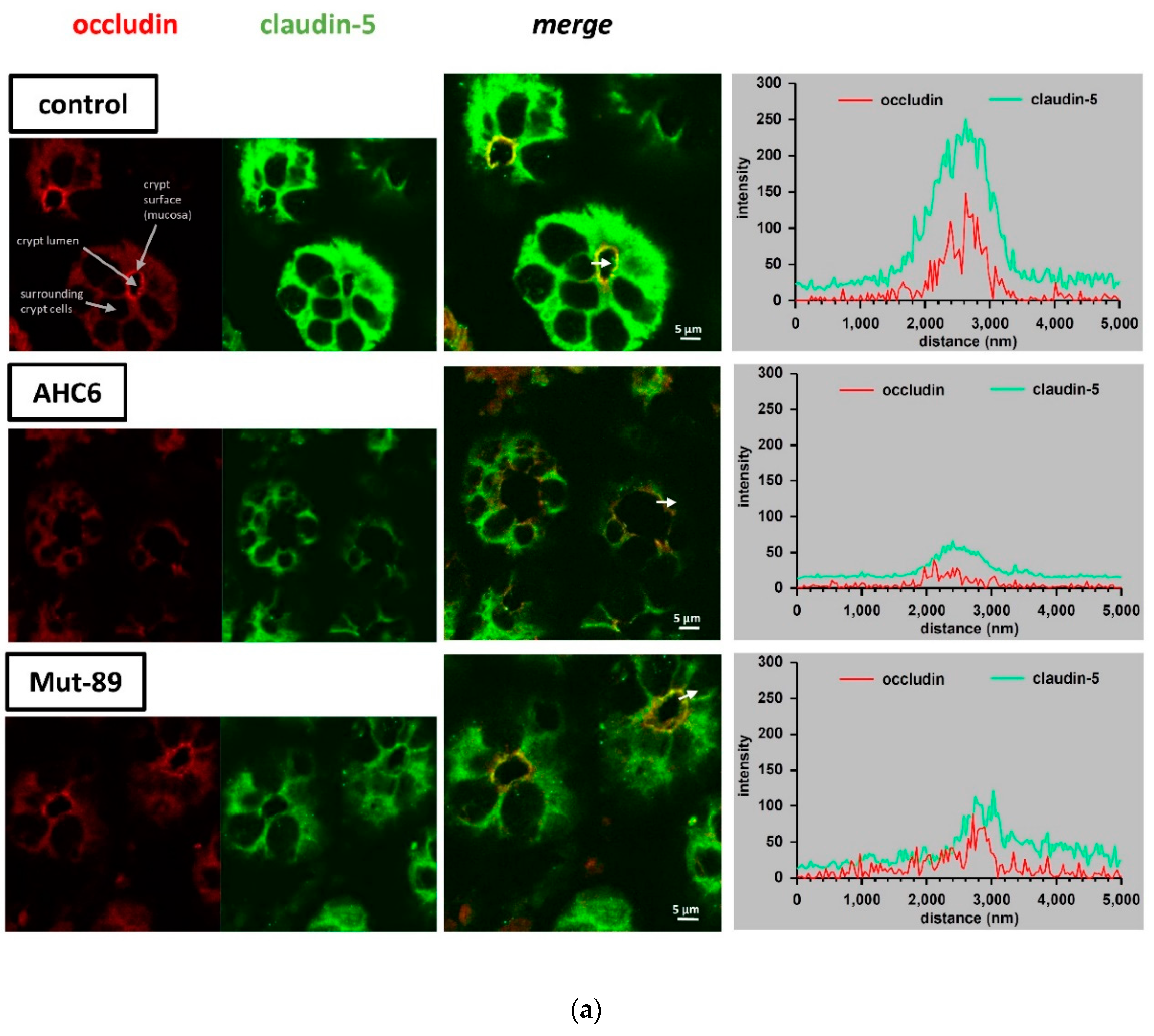 Ijms 20 05595 g004a