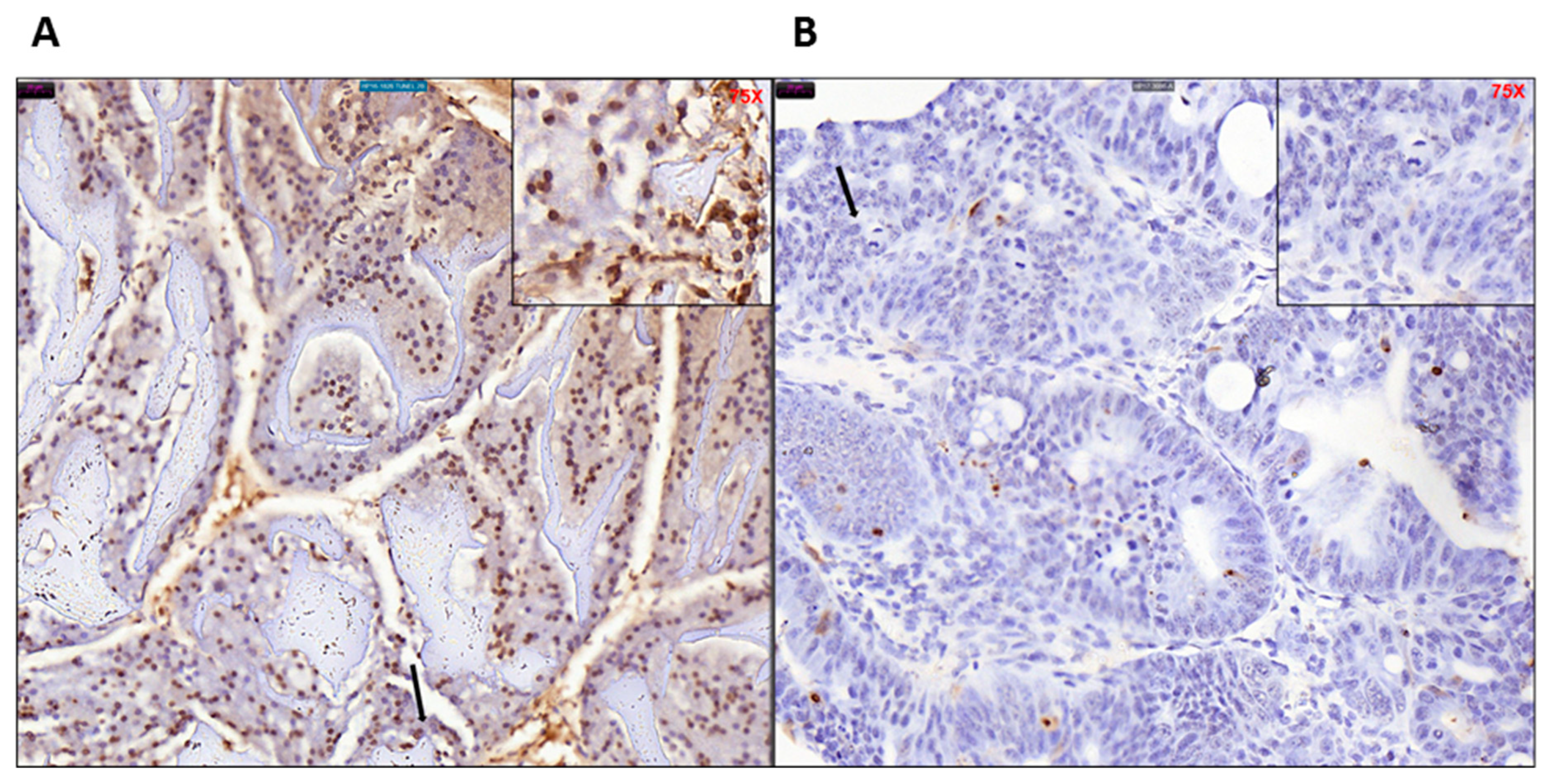 Ijms 20 05677 g008 550