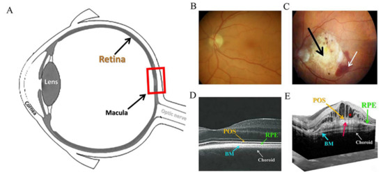 The Regulation of NFE2L2 (NRF2) Signalling and Epithelial-to