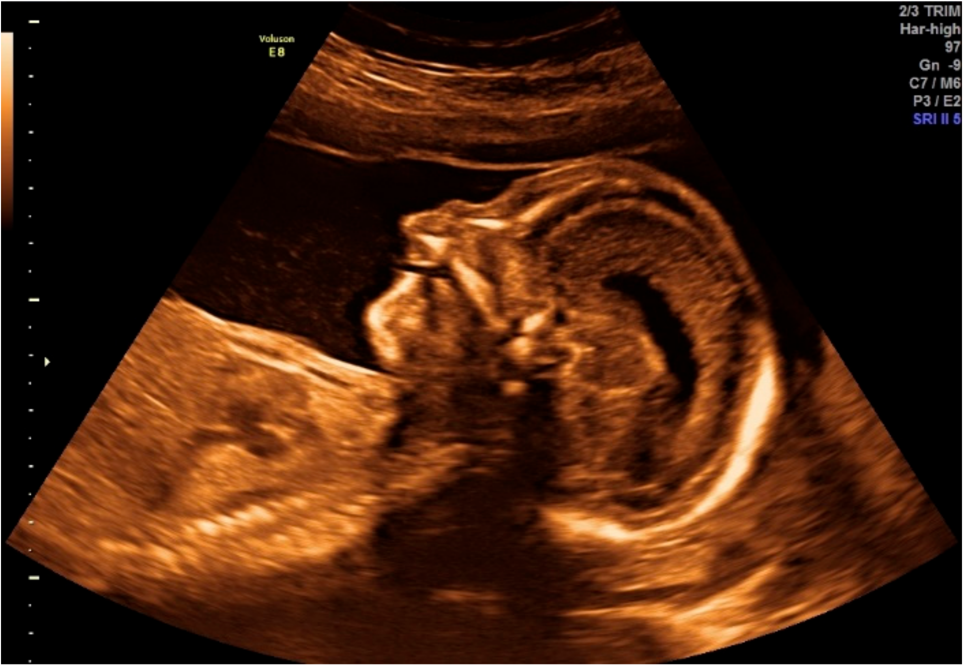 Ijms 20 06006 g001 Ijms 20 06006 g001