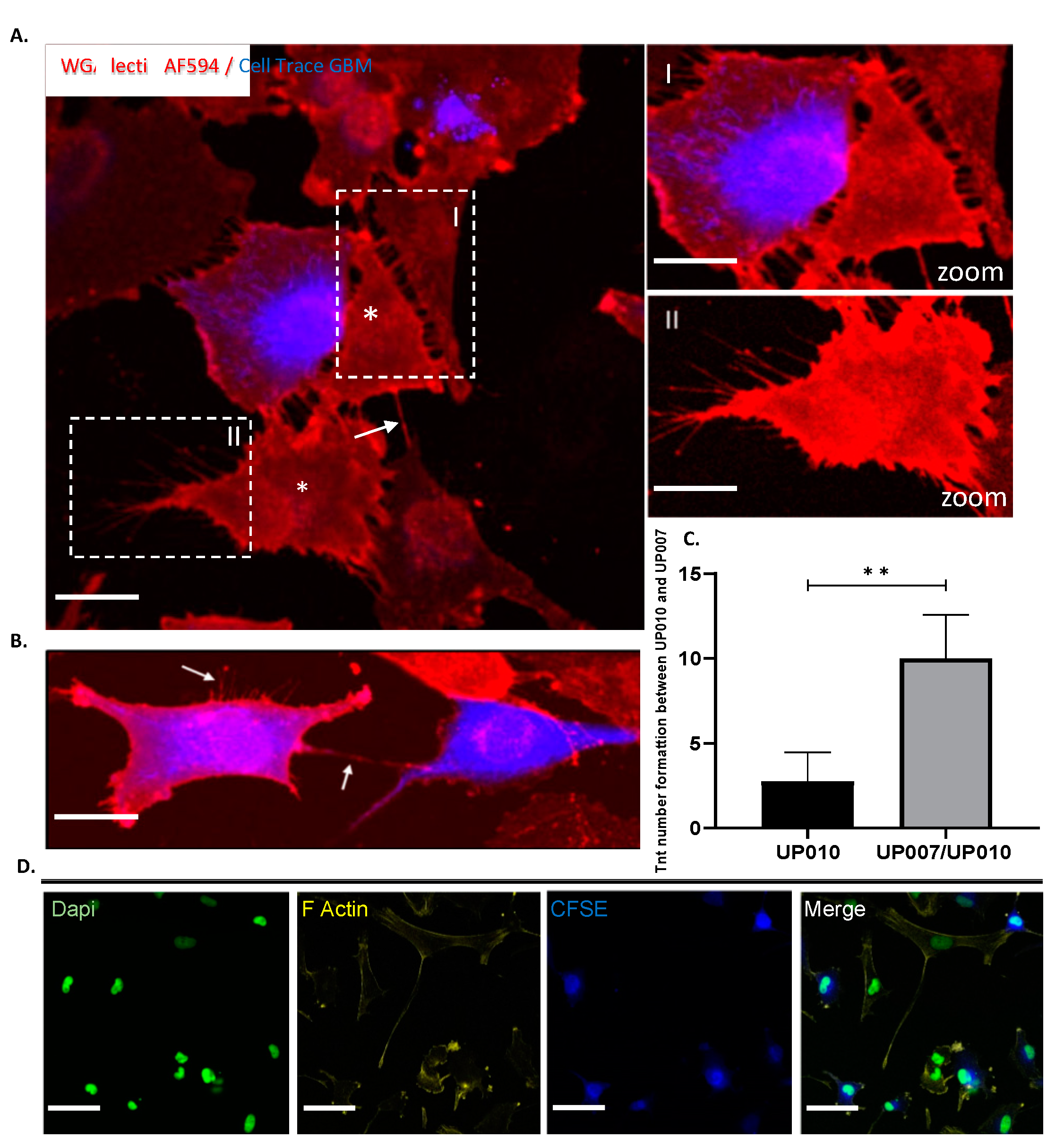 Ijms Free Full Text Pre Clinical Drug Testing In 2d And 3d Human In Vitro Models Of Glioblastoma Incorporating Non Neoplastic Astrocytes Tunneling Nano Tubules And Mitochondrial Transfer Modulates Cell Behavior And Therapeutic Ijms Free Full Text Pre Clinical Drug Testing In 2d And 3d Human In Vitro Models Of Glioblastoma Incorporating Non Neoplastic Astrocytes Tunneling Nano Tubules And Mitochondrial Transfer Modulates Cell Behavior And Therapeutic