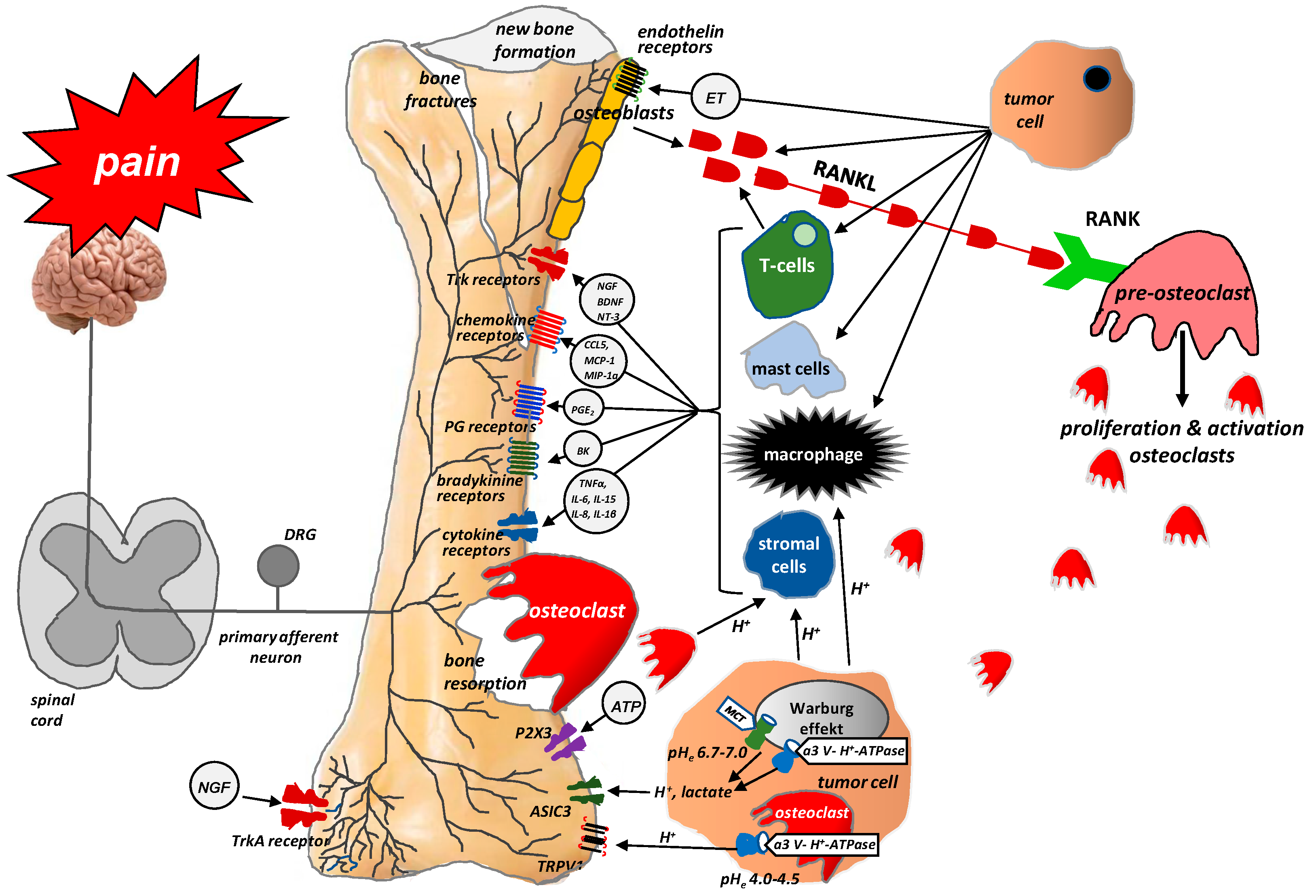 What happens when prostate cancer spreads to the bones