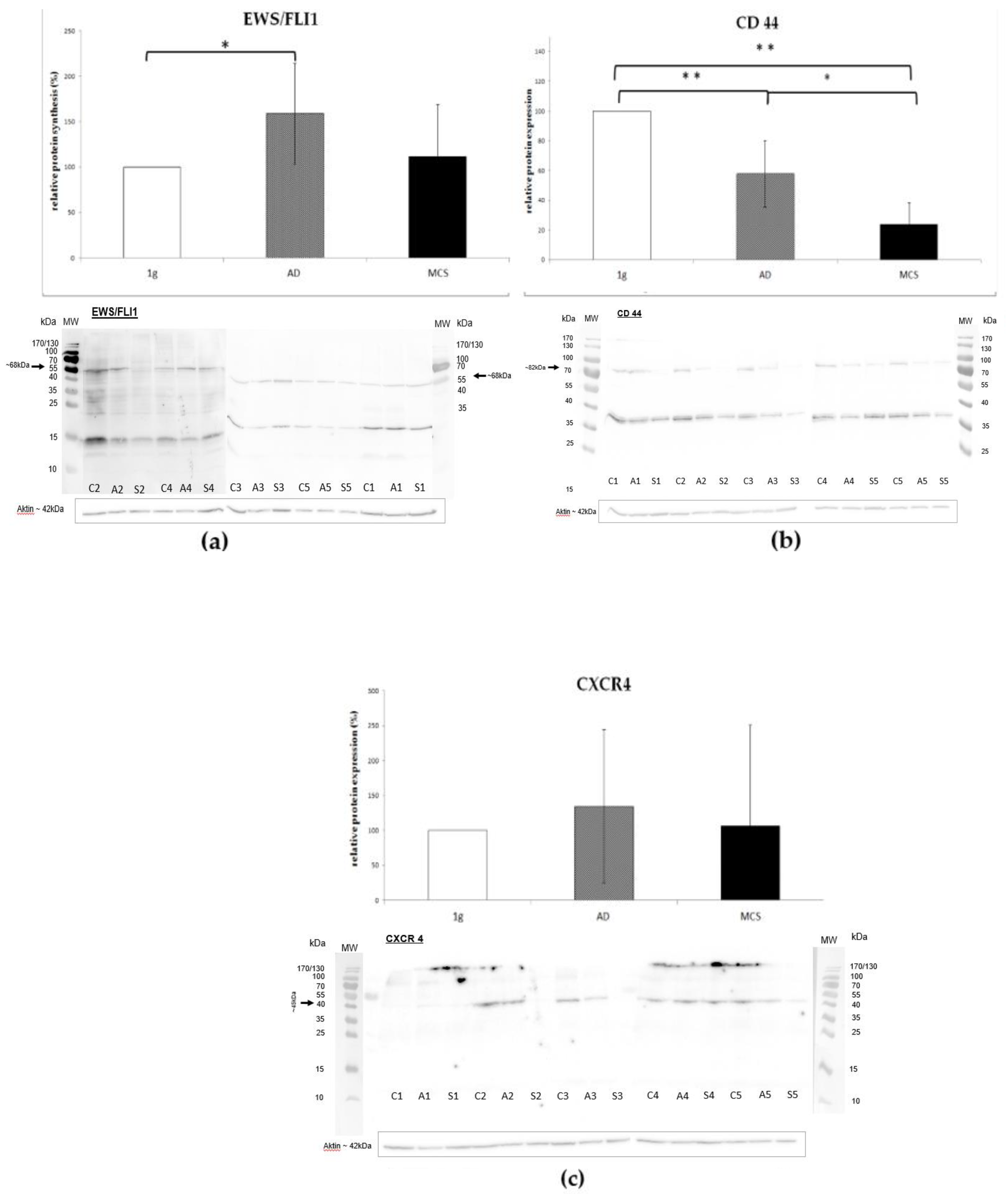 stage 4 breast cancer spread to brain life expectancy