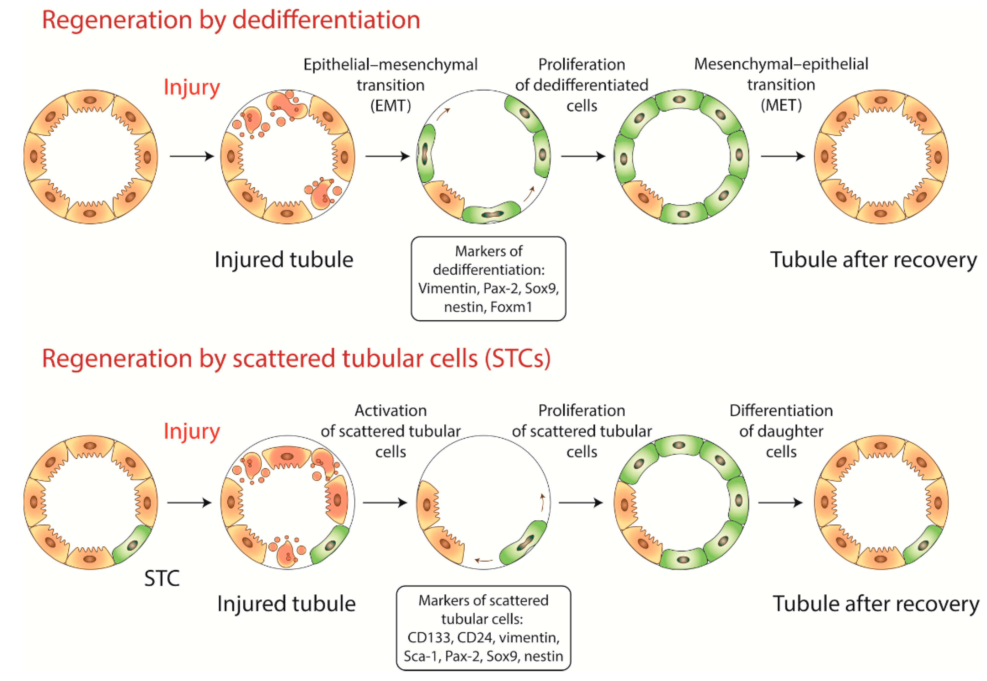 IJMS | Free Full-Text | Kidney Cells Regeneration: Dedifferentiation of Tubular  Epithelium, Resident Stem Cells and Possible Niches for Renal Progenitors |  HTML