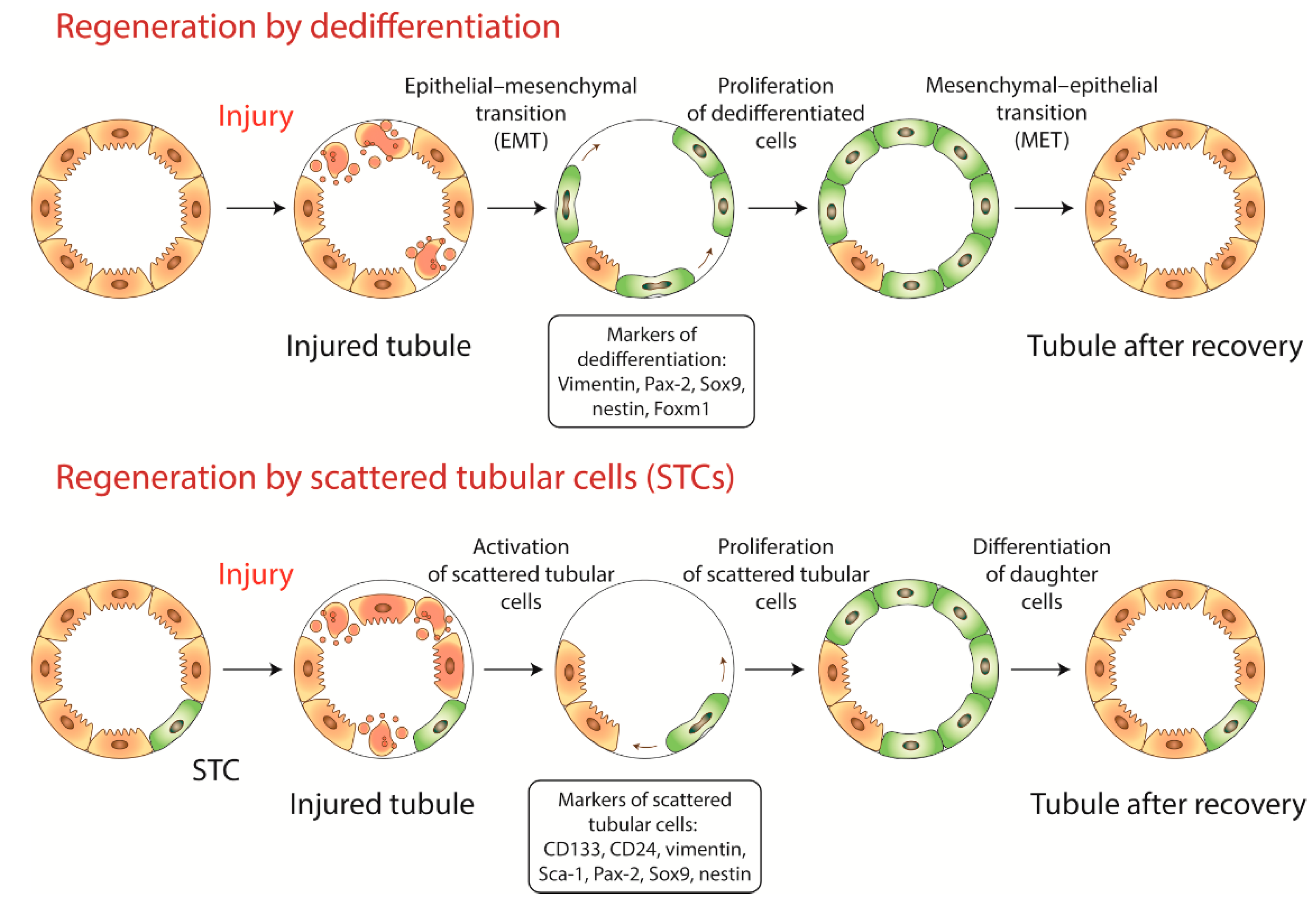 Ijms Free Full Text Kidney Cells Regeneration Dedifferentiation Of Tubular Epithelium Resident Stem Cells And Possible Niches For Renal Progenitors Html