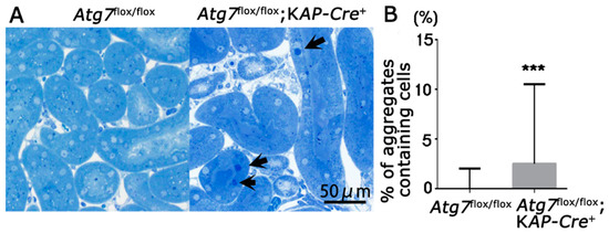 IJMS | Special Issue : Biogenesis and Functional Roles of Lysosomes