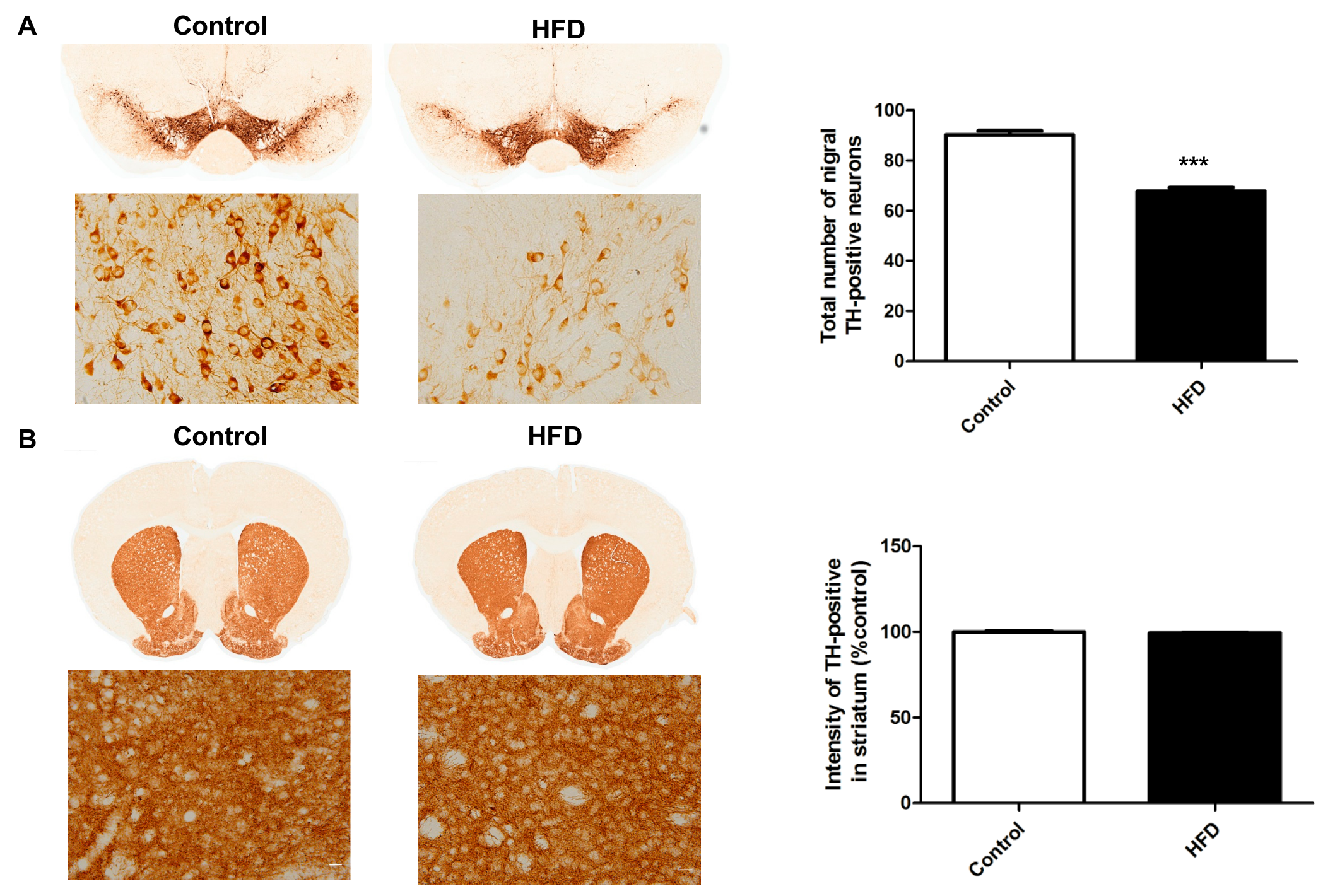 Ijms Free Full Text High Fat Diet Suppresses Peroxisome Proliferator Activated Receptors And Reduces Dopaminergic Neurons In The Substantia Nigra Html