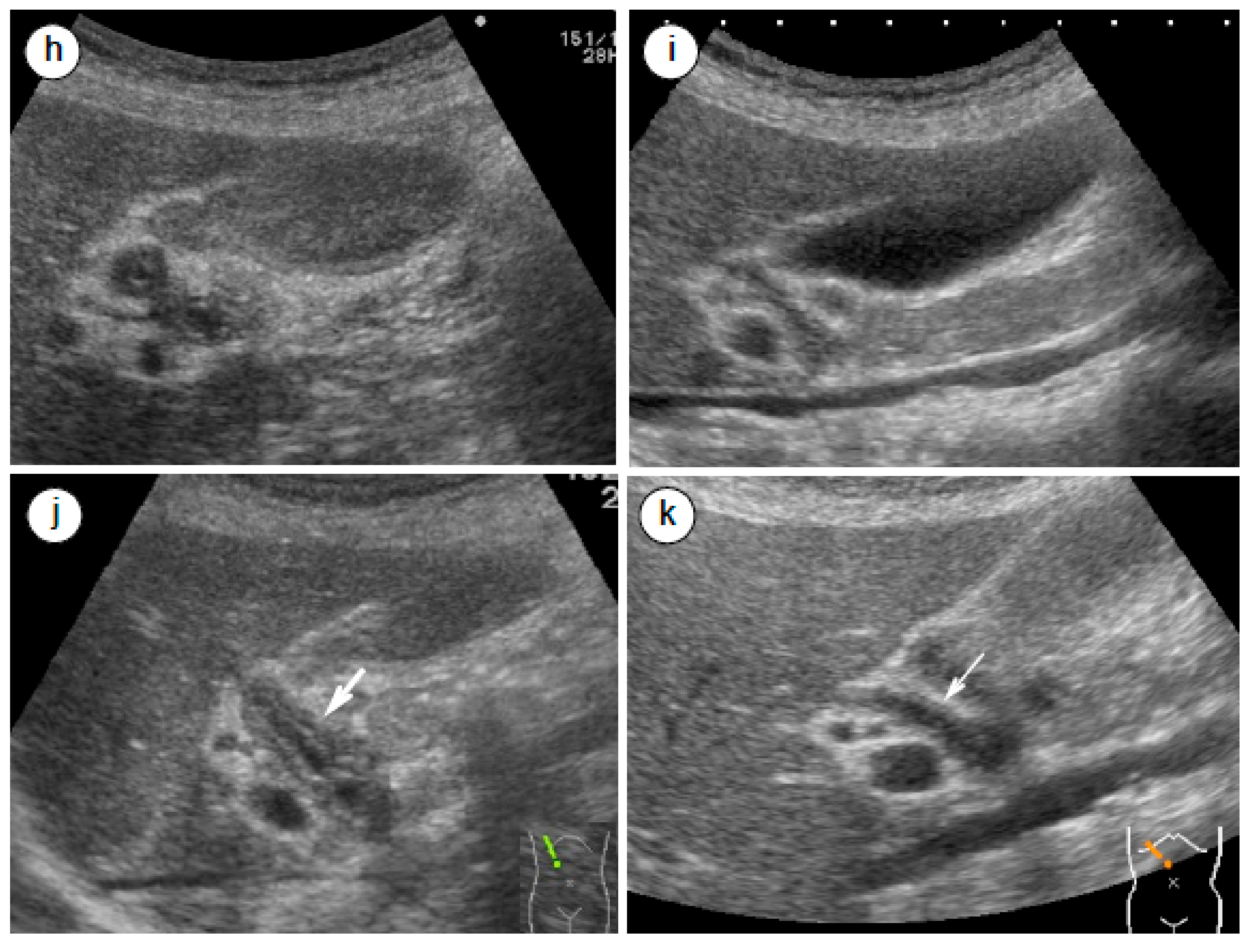 Ijms 21 00257 g002b Ijms 21 00257 g002b