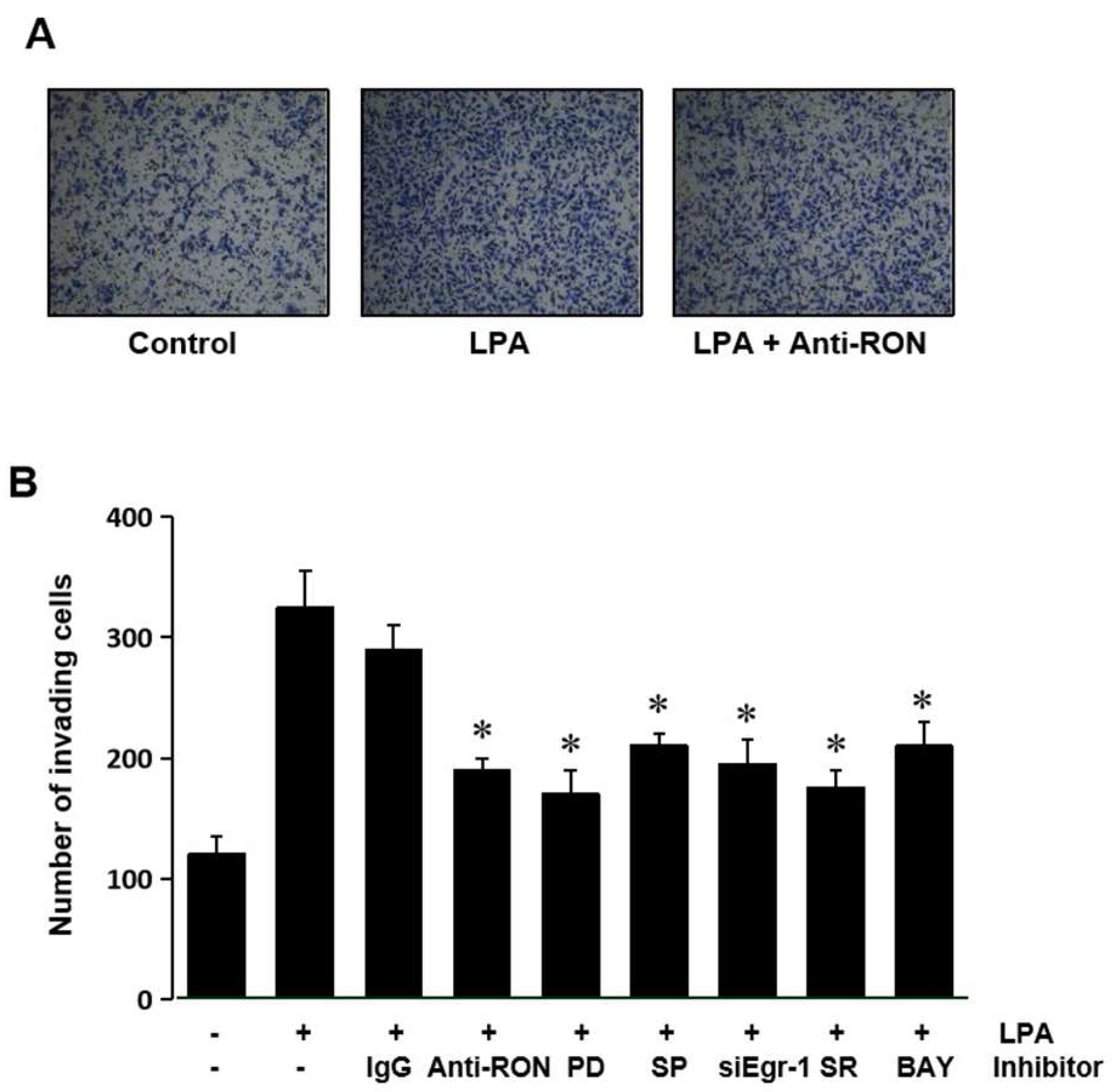Ijms 21 00304 g008 Ijms 21 00304 g008