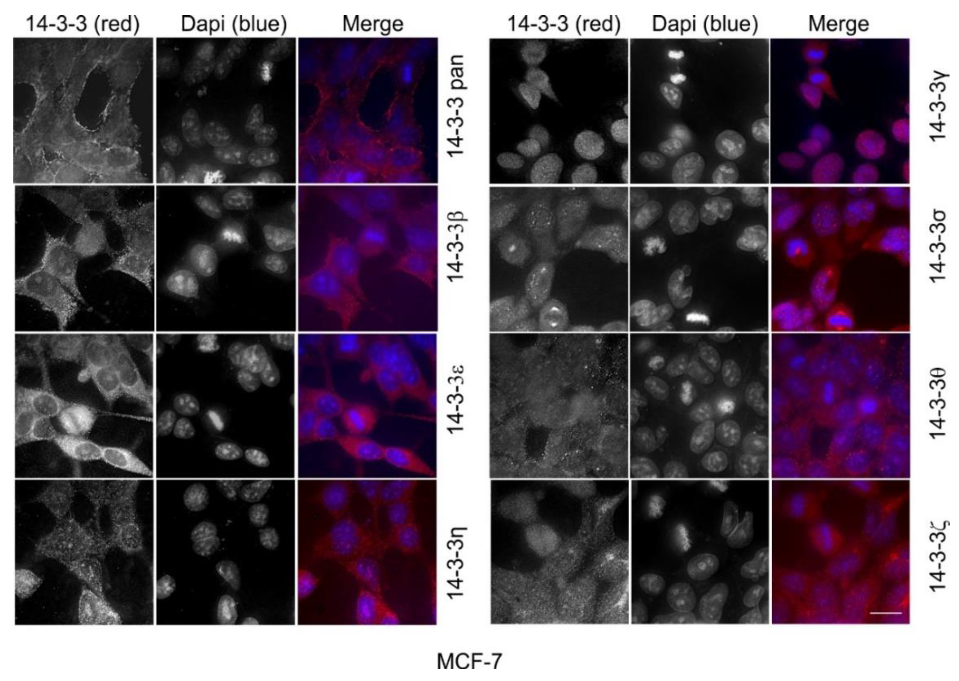 Ijms 21 00318 g013 Ijms 21 00318 g013