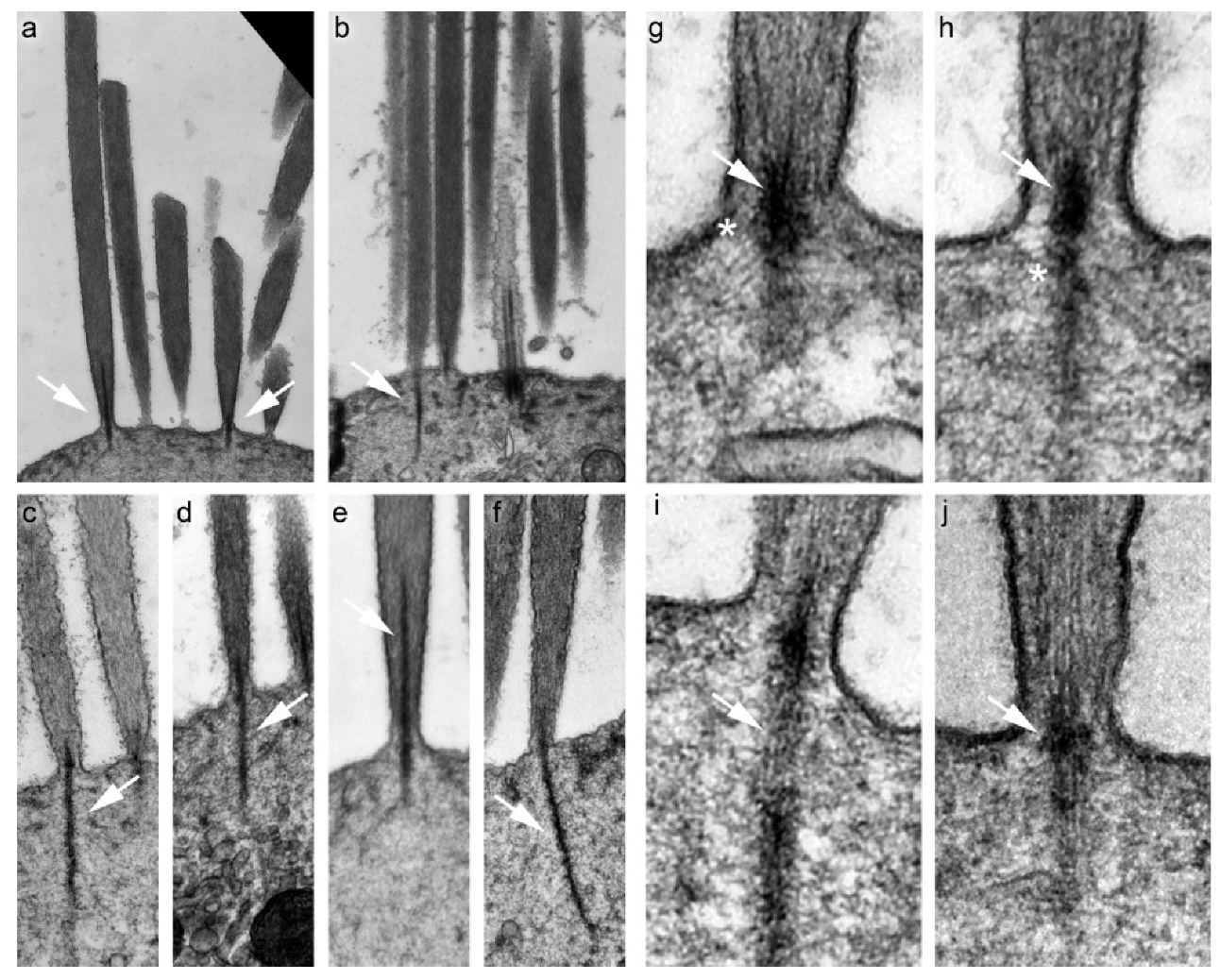 Patent On foot Contempt IJMS | Free Full-Text | Stereocilia Rootlets: Actin-Based Structures That Are Essential for Structural Stability of the Hair Bundle | HTML Patent On foot Contempt IJMS | Free Full-Text | Stereocilia Rootlets: Actin-Based Structures That Are Essential for Structural Stability of the Hair Bundle | HTML
