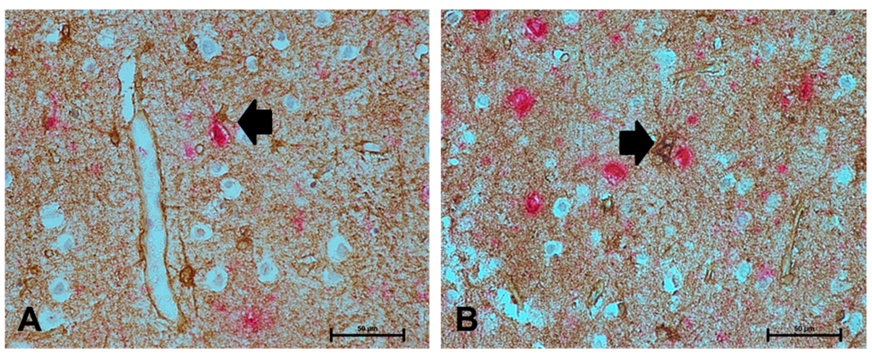 Ijms 21 00340 g004 Ijms 21 00340 g004