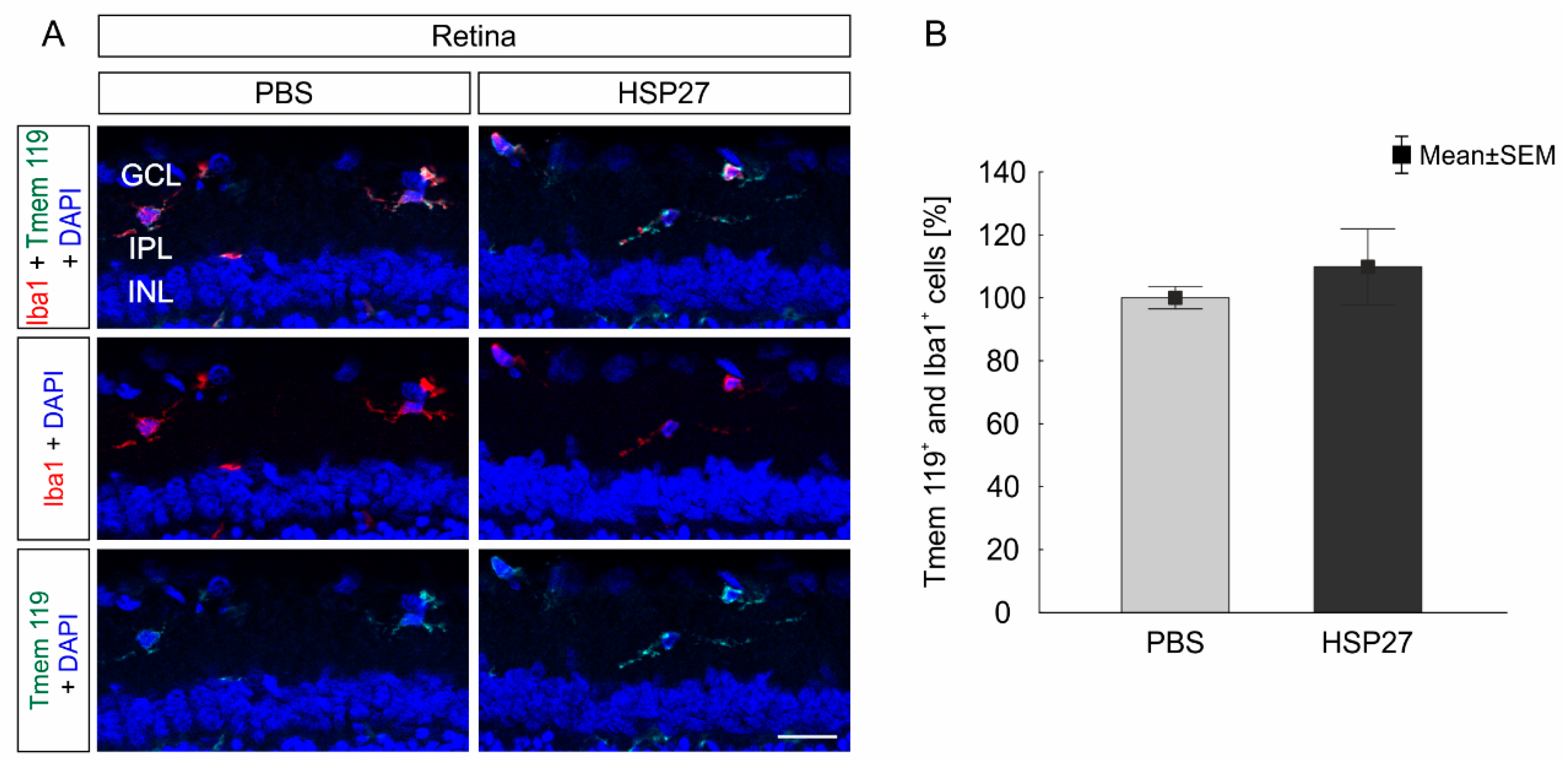 Ijms 21 00549 g005 Ijms 21 00549 g005