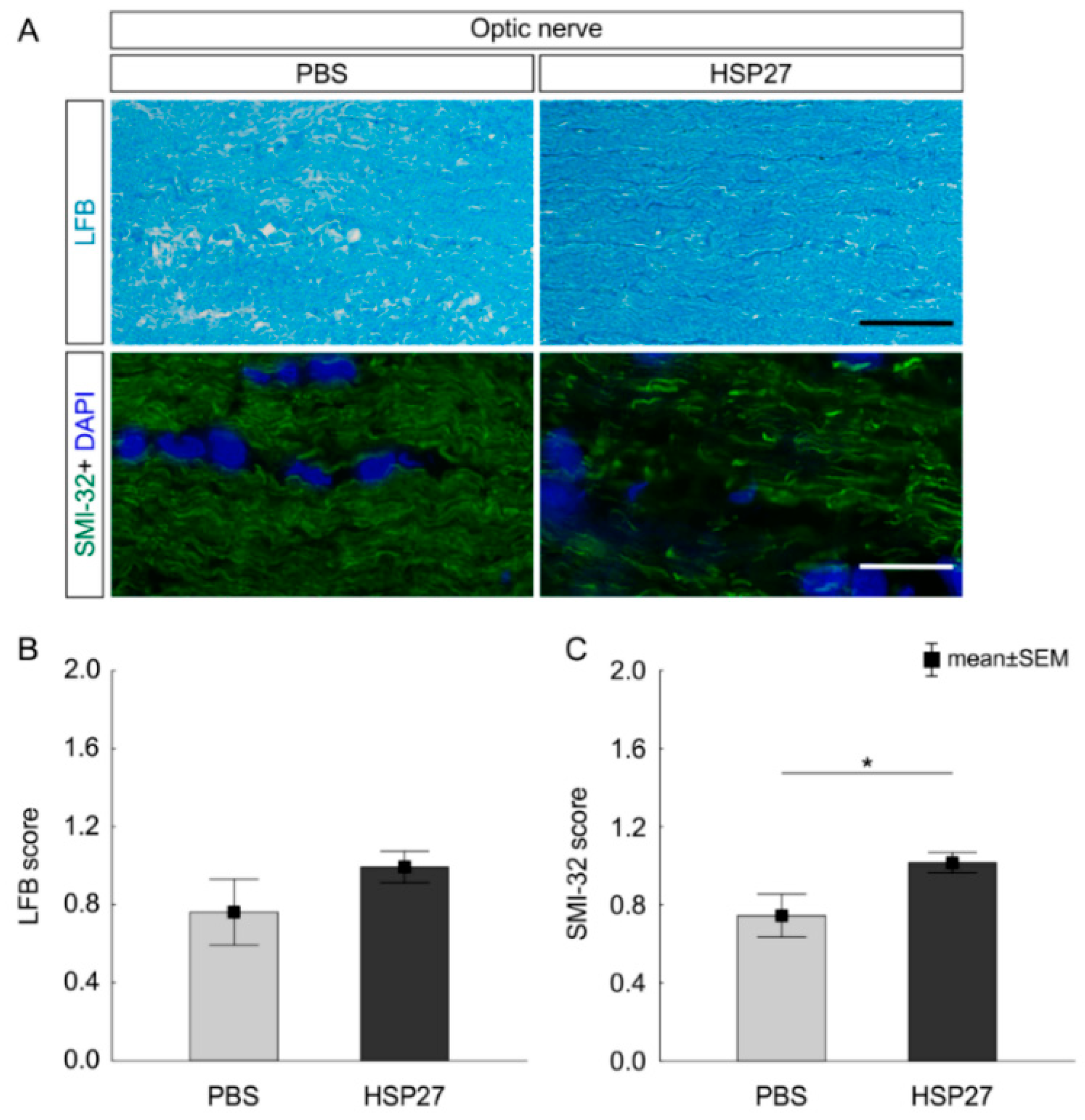 Ijms 21 00549 g007 Ijms 21 00549 g007