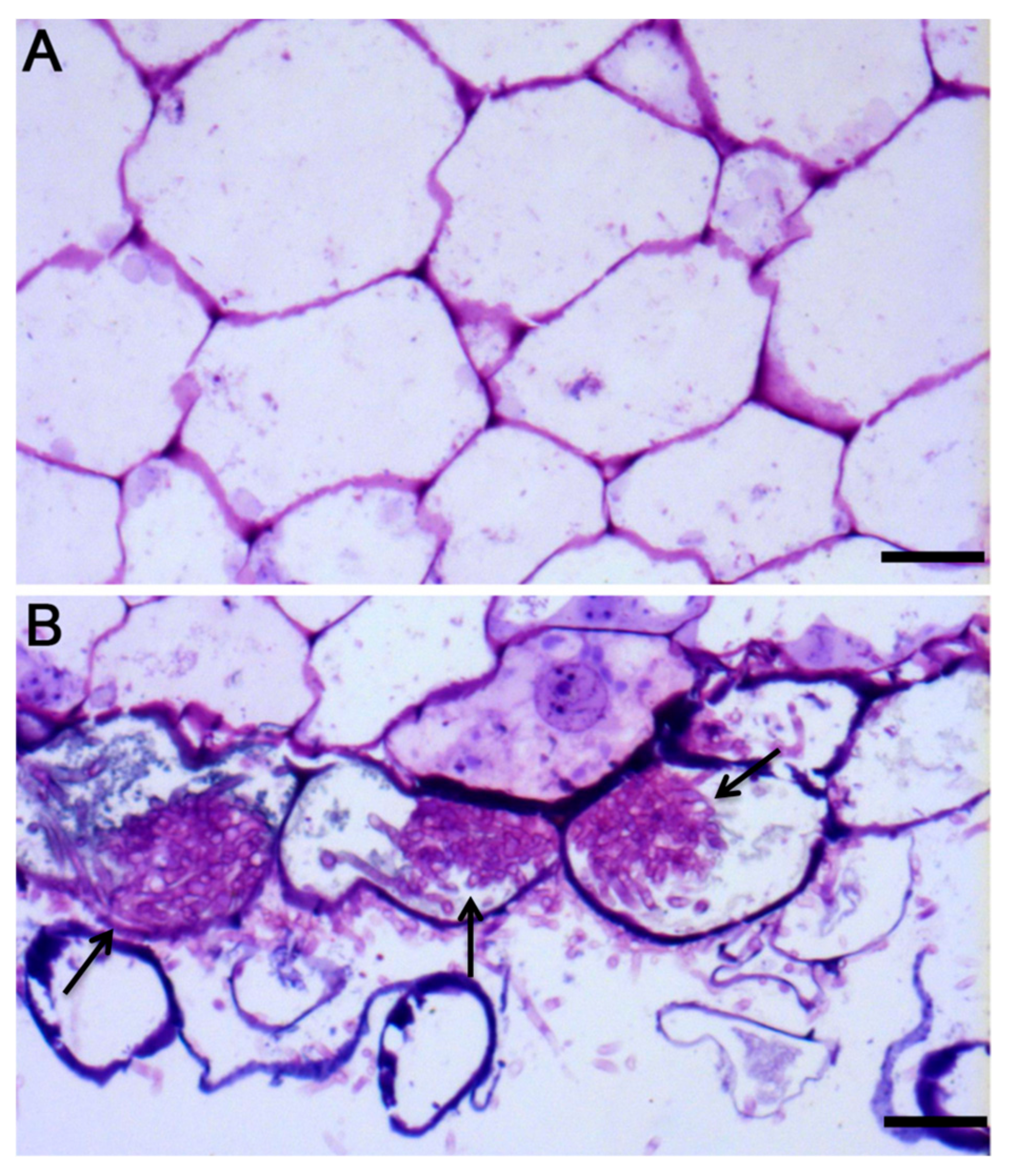 Combined Metabolome and Transcriptome Analyses Reveal the