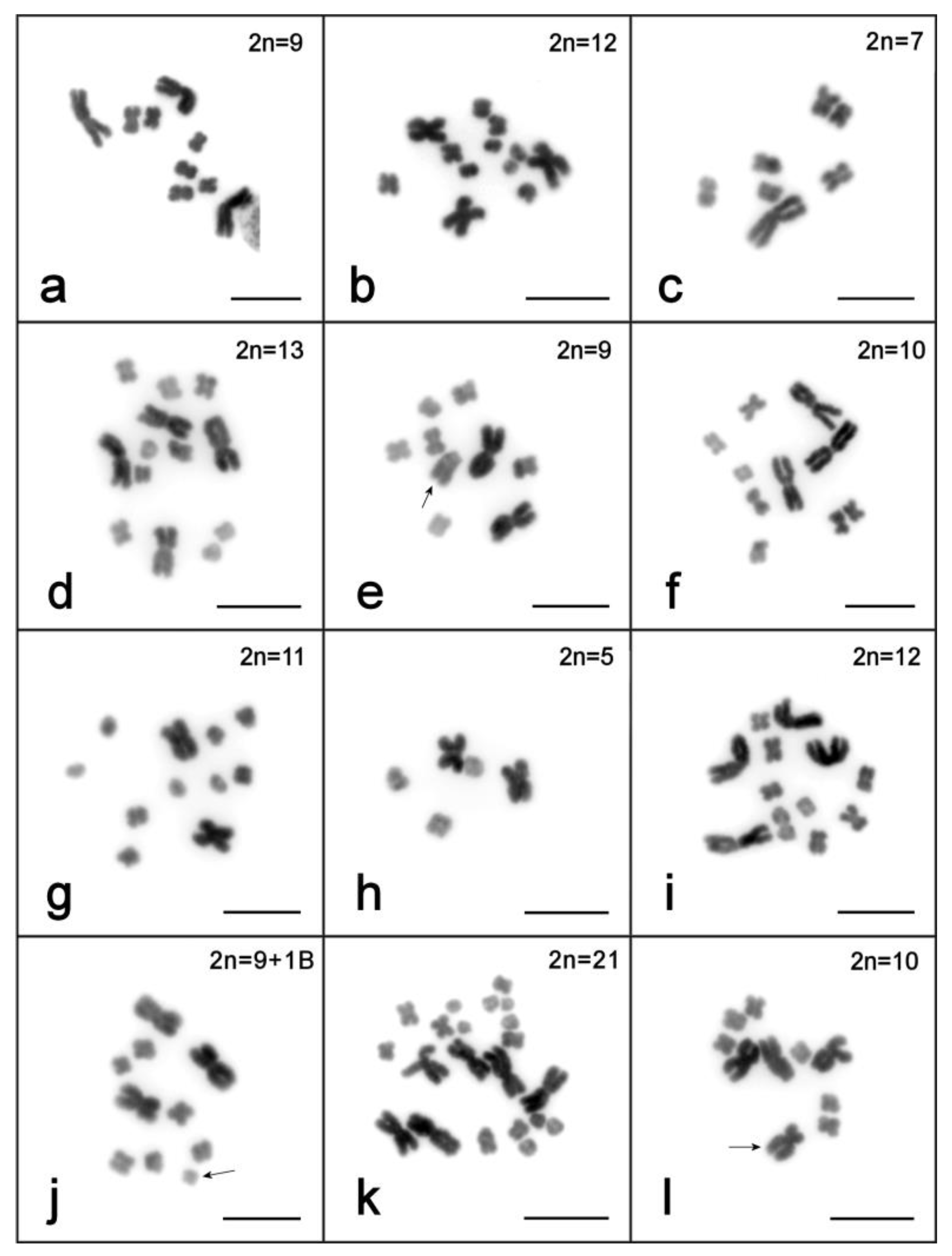 Karyotype Analysis of Human Chromosome | Easy Biology Class Karyotype Analysis of Human Chromosome | Easy Biology Class