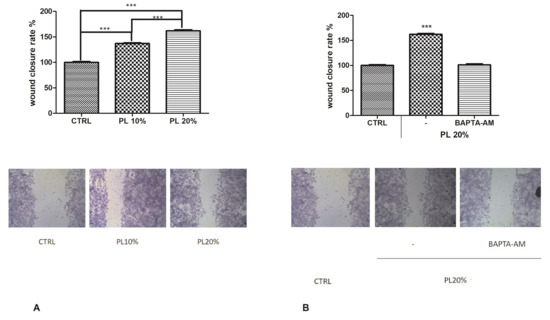 Endothelial Response Boosted by Platelet Lysate: The Involvement