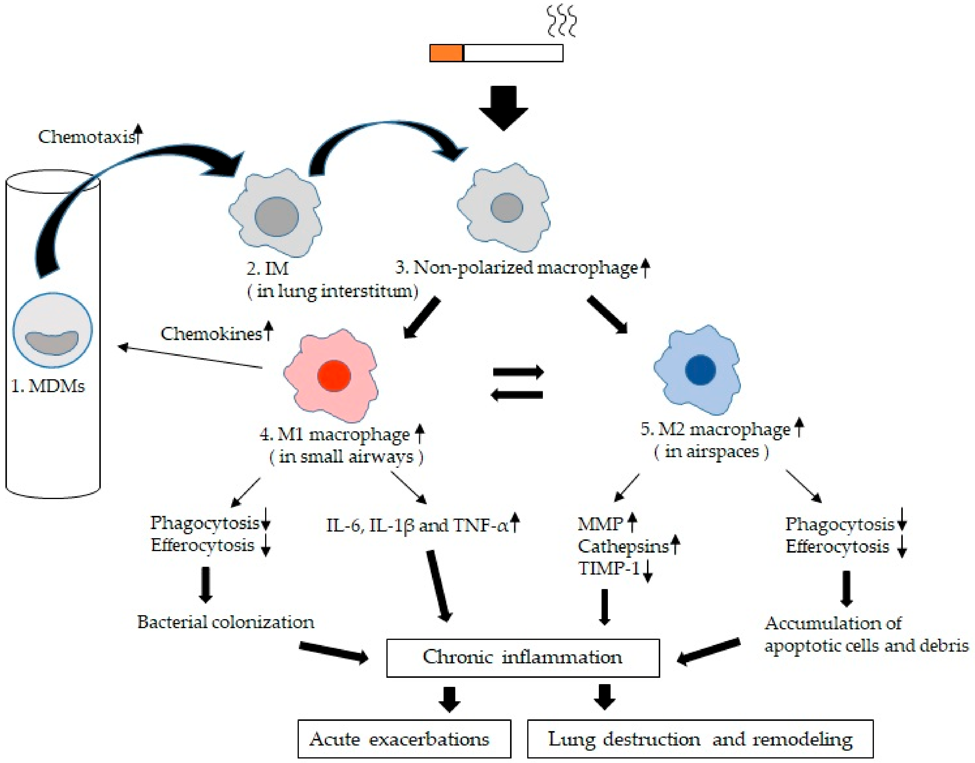 Ijms Free Full Text Lung Macrophage Functional Properties In Chronic Obstructive Pulmonary Disease Html