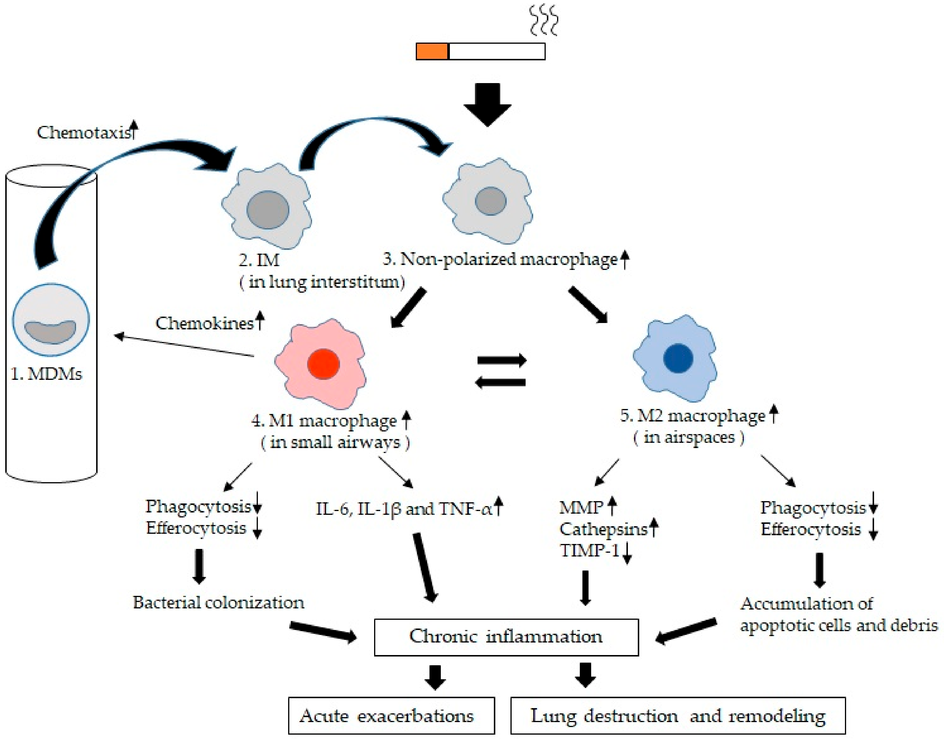 IJMS | Free Full-Text | Lung Macrophage Functional Properties in