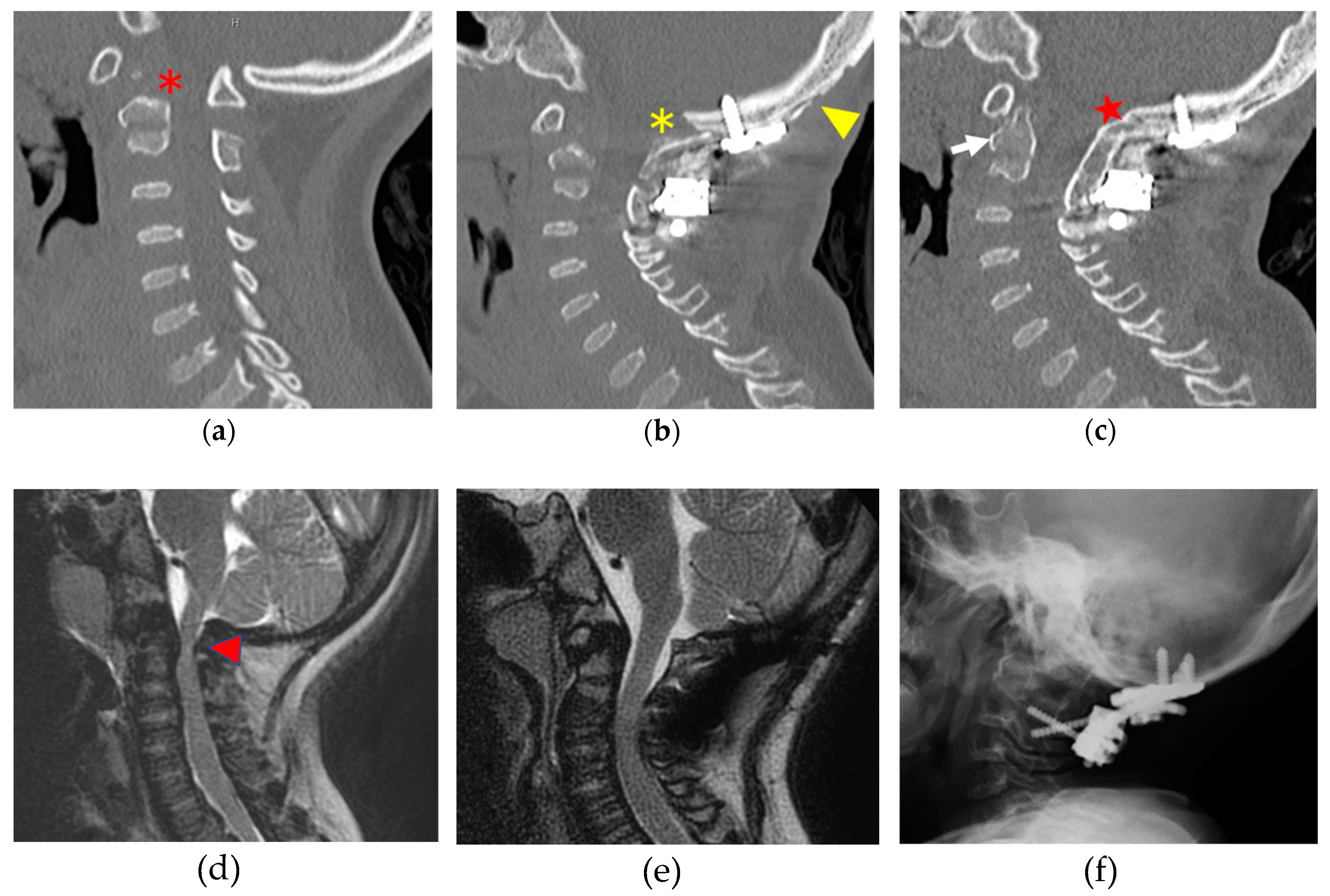 Ijms 21 01171 g003 Ijms 21 01171 g003