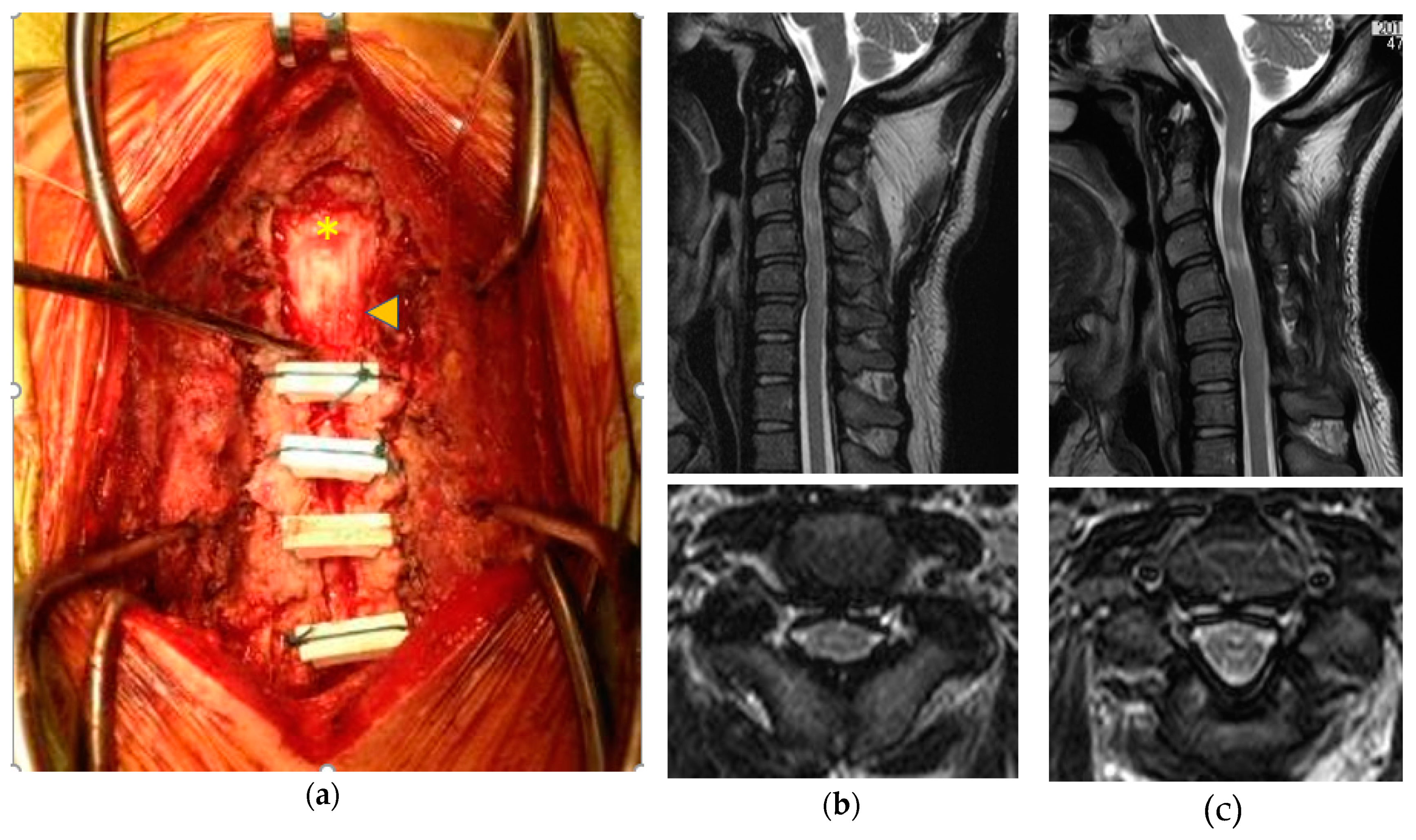 Ijms 21 01171 g006 Ijms 21 01171 g006