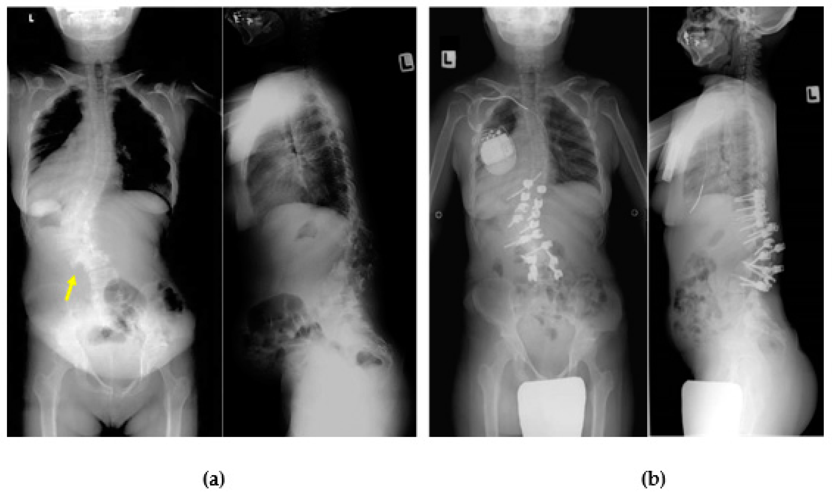 Ijms 21 01171 g008 Ijms 21 01171 g008