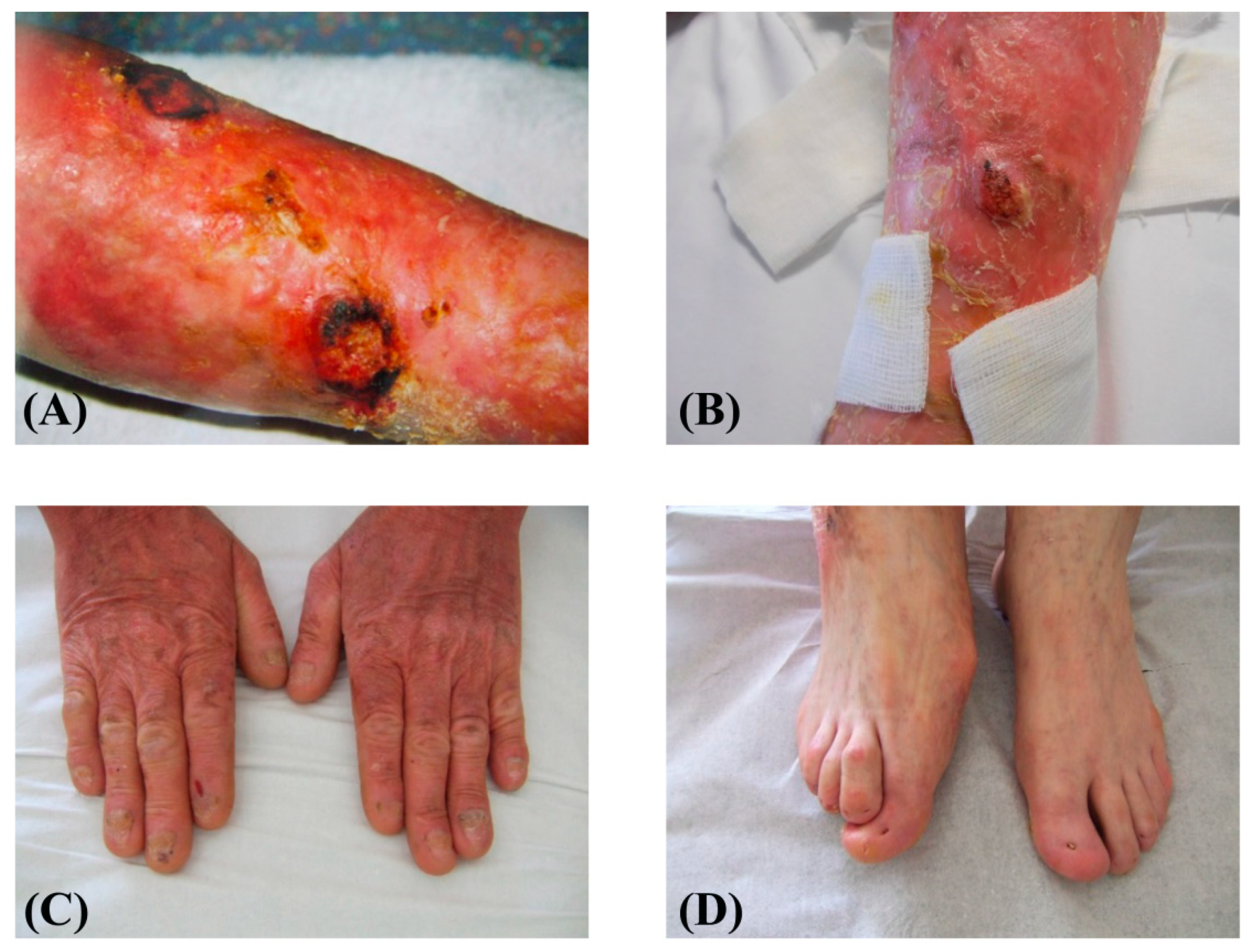 Ijms 21 01426 g001 Ijms 21 01426 g001