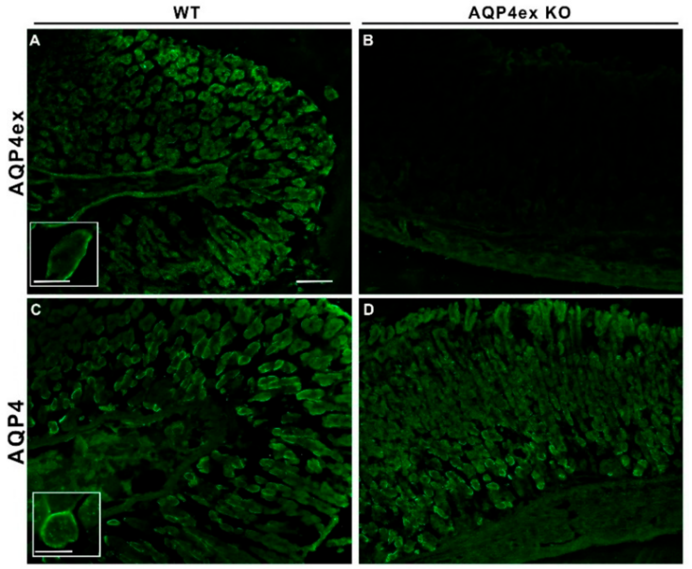 pocopocopocorinページ Tissue Distribution of the Readthrough Isoform of AQP4