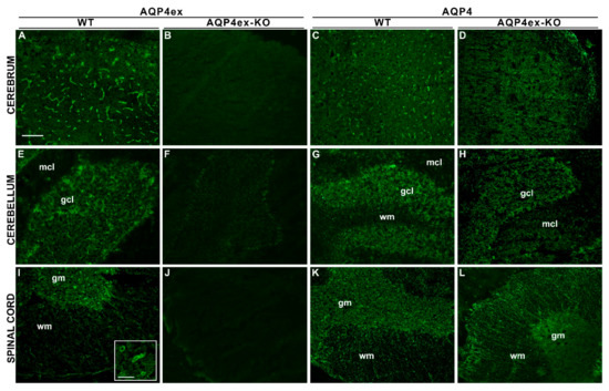 Tissue Distribution of the Readthrough Isoform of AQP4