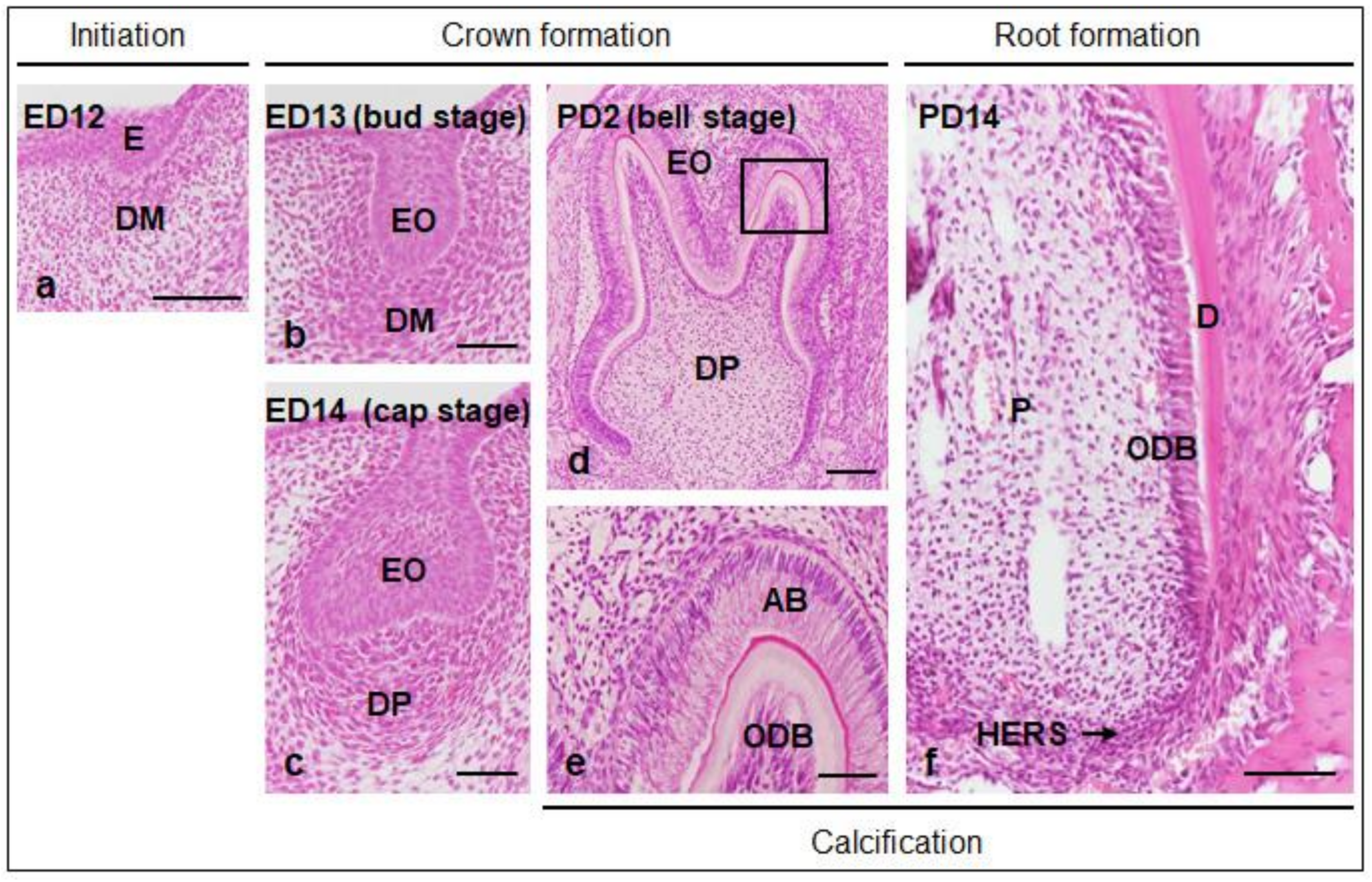 IJMS | Free Full-Text | Sonic Hedgehog Signaling and Tooth Development