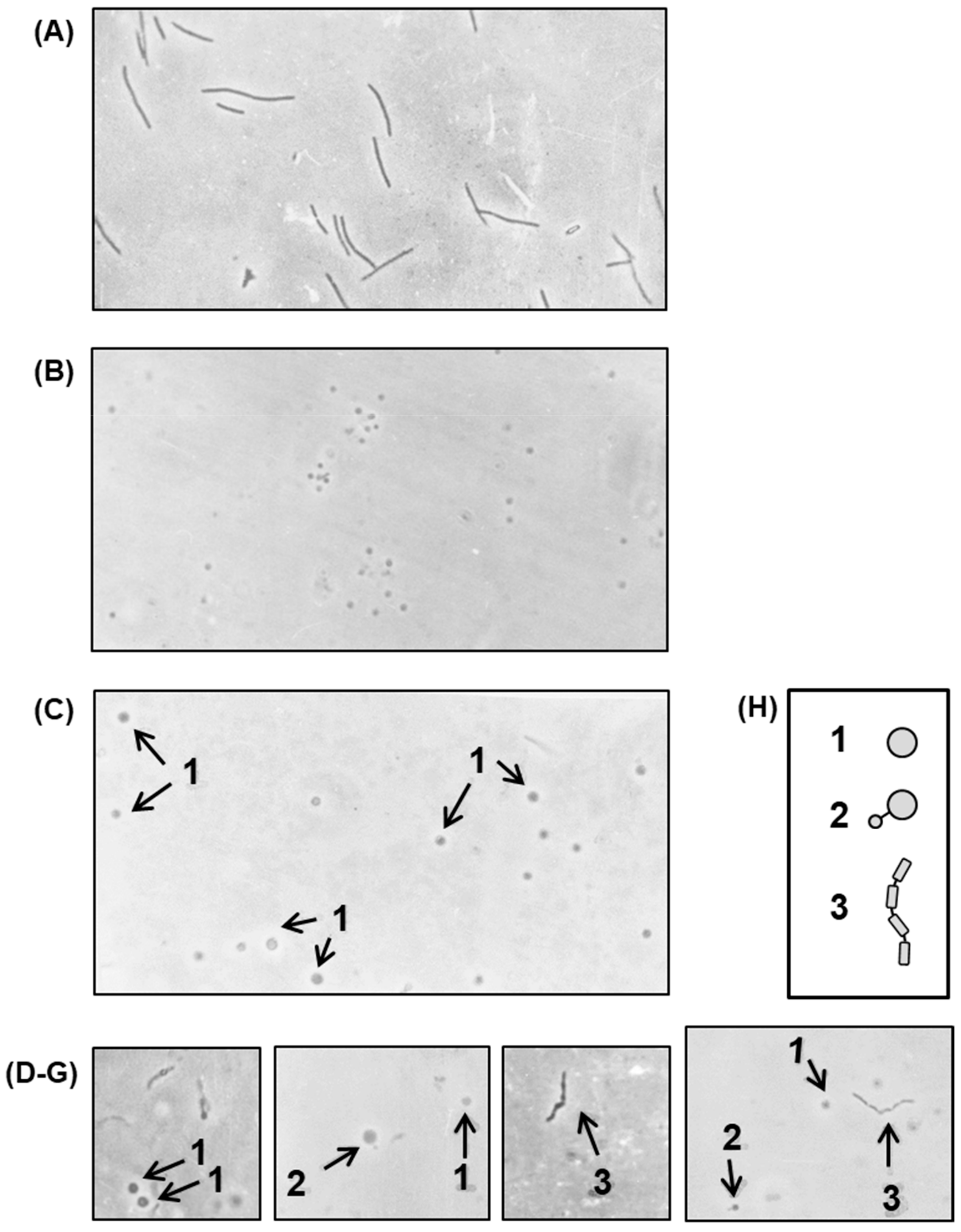Ijms 21 01667 g008