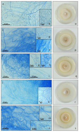 Ijms Free Full Text Combined Effect Of Light And Nutrients On The Micromorphology Of The White Rot Fungus Cerrena Unicolor Html